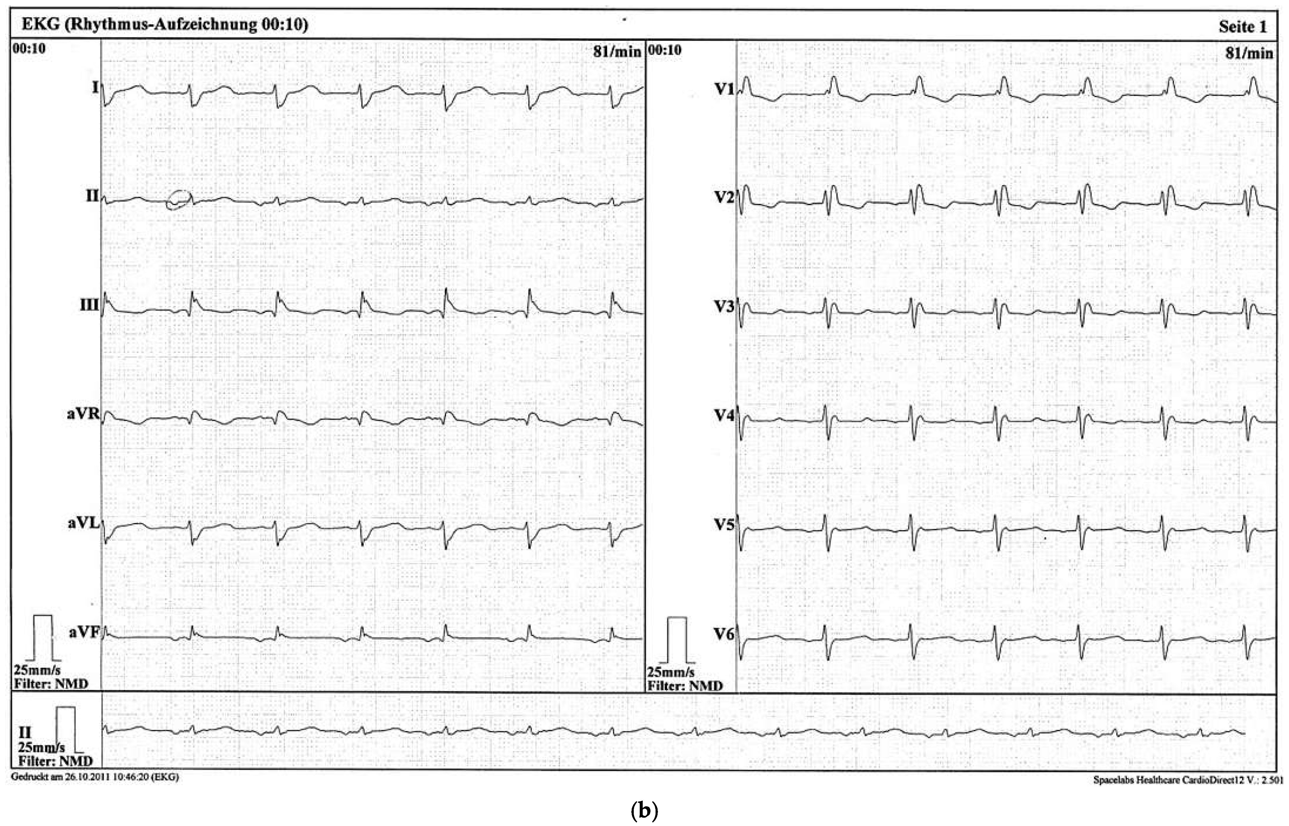 Cardiovascmed 16 00250 g001b