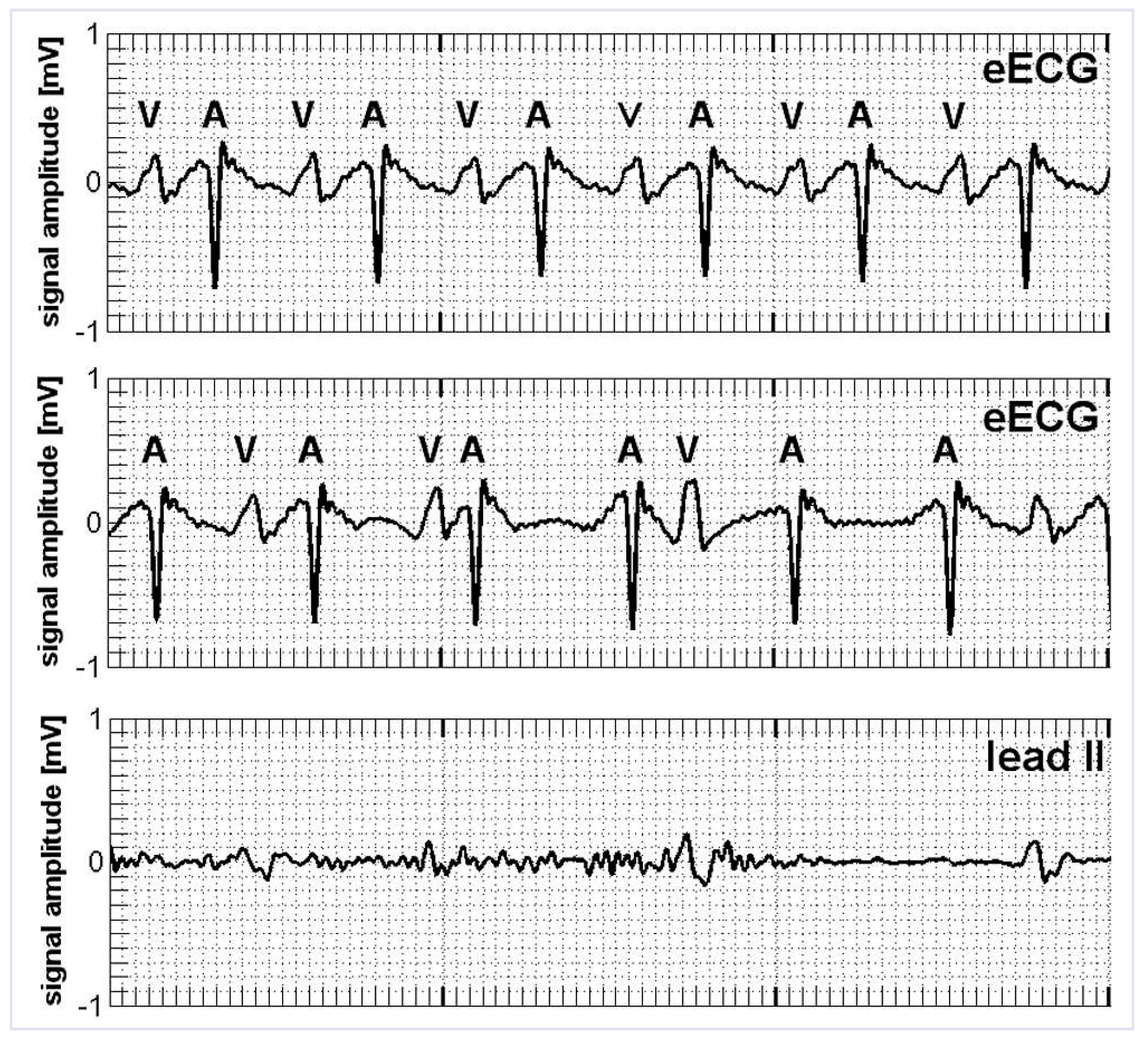 Cardiovascmed 16 00250 g002