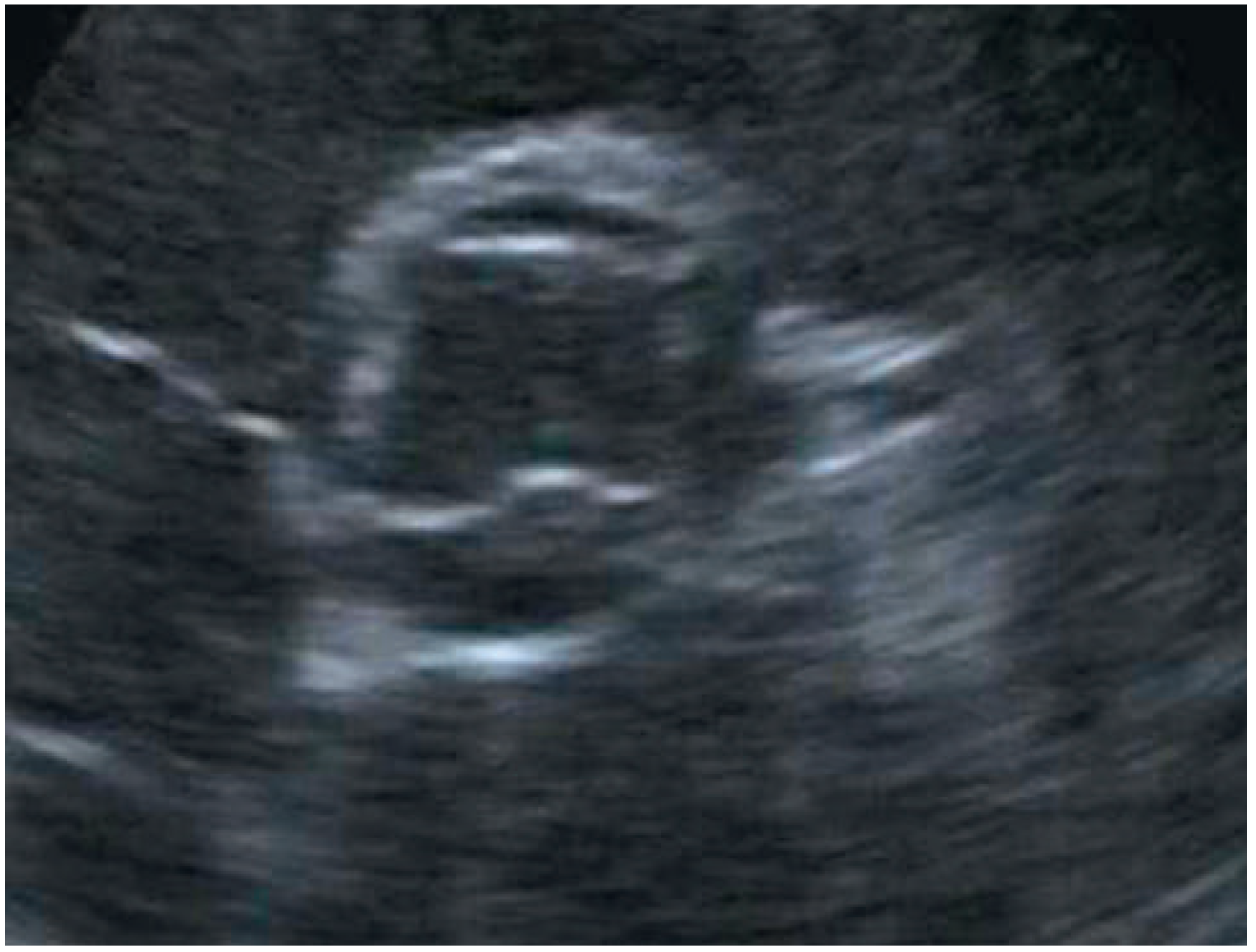 Cardiovascmed 16 00254 g001