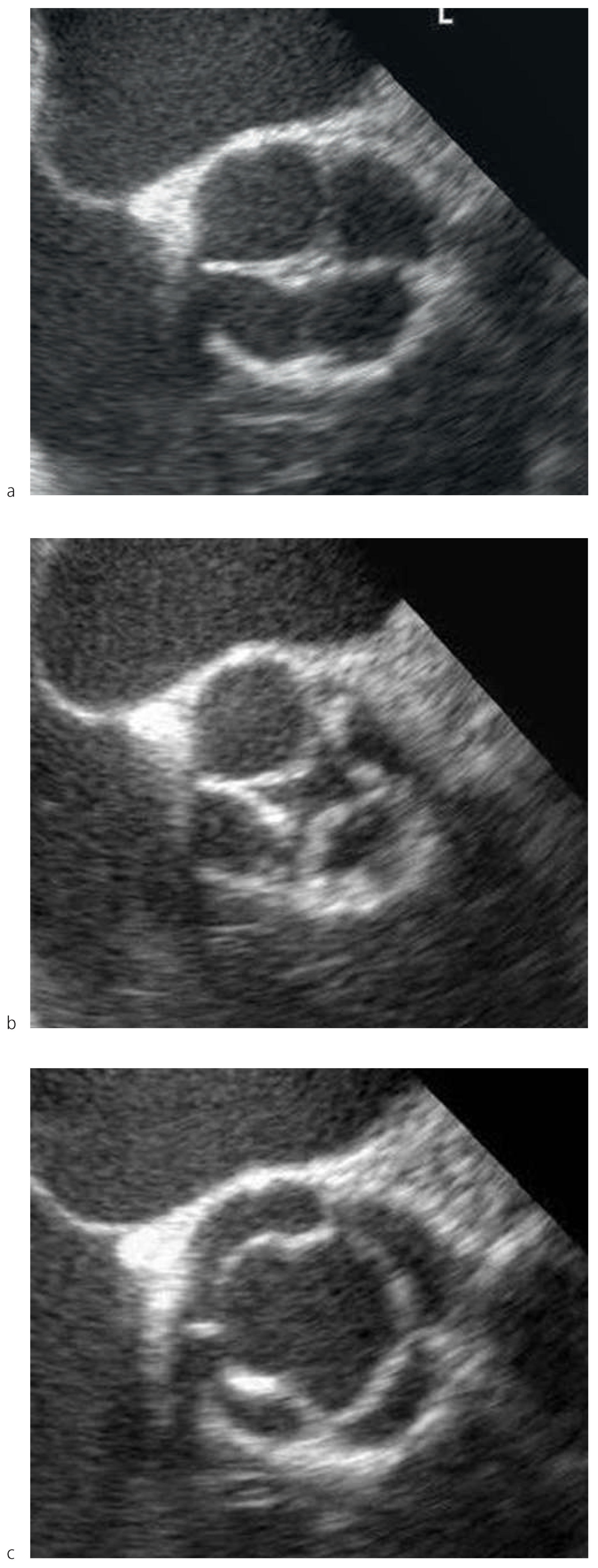 Cardiovascmed 16 00254 g002