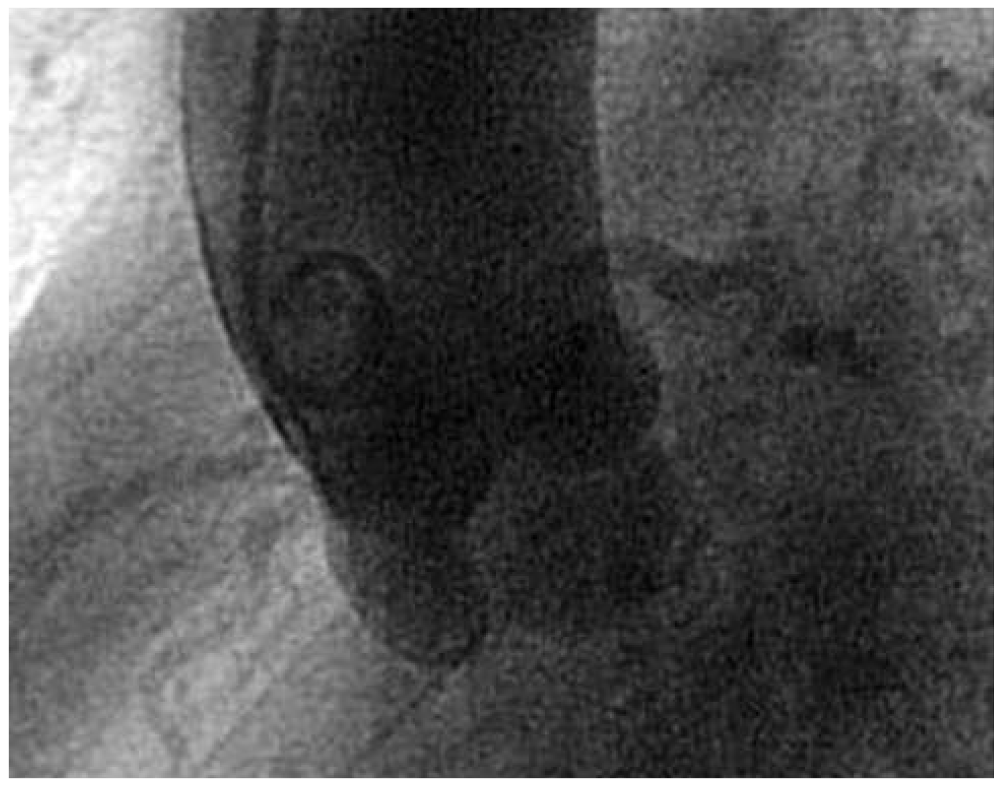 Cardiovascmed 16 00254 g004