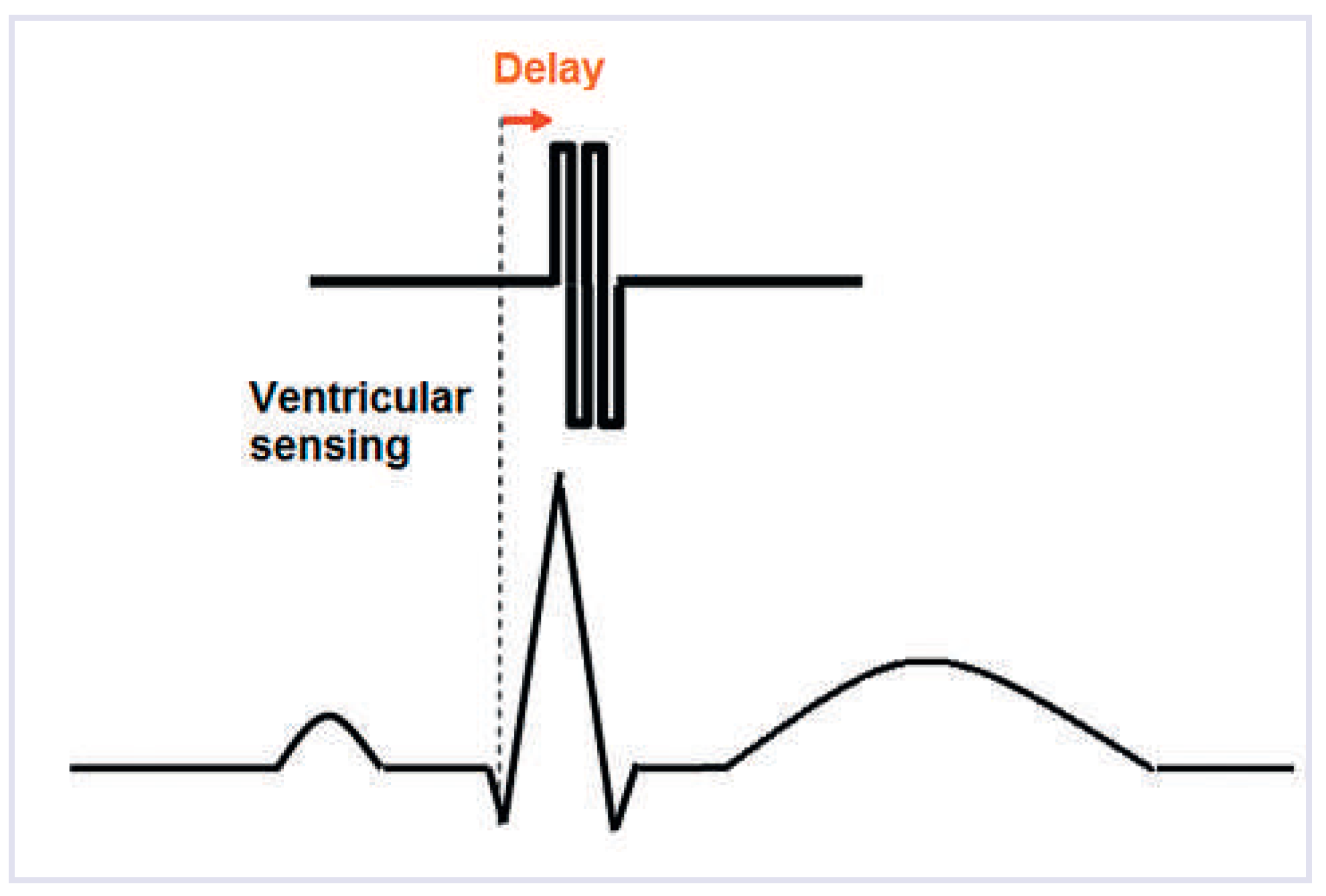 Cardiovascmed 16 00259 g001 Cardiovascmed 16 00259 g001