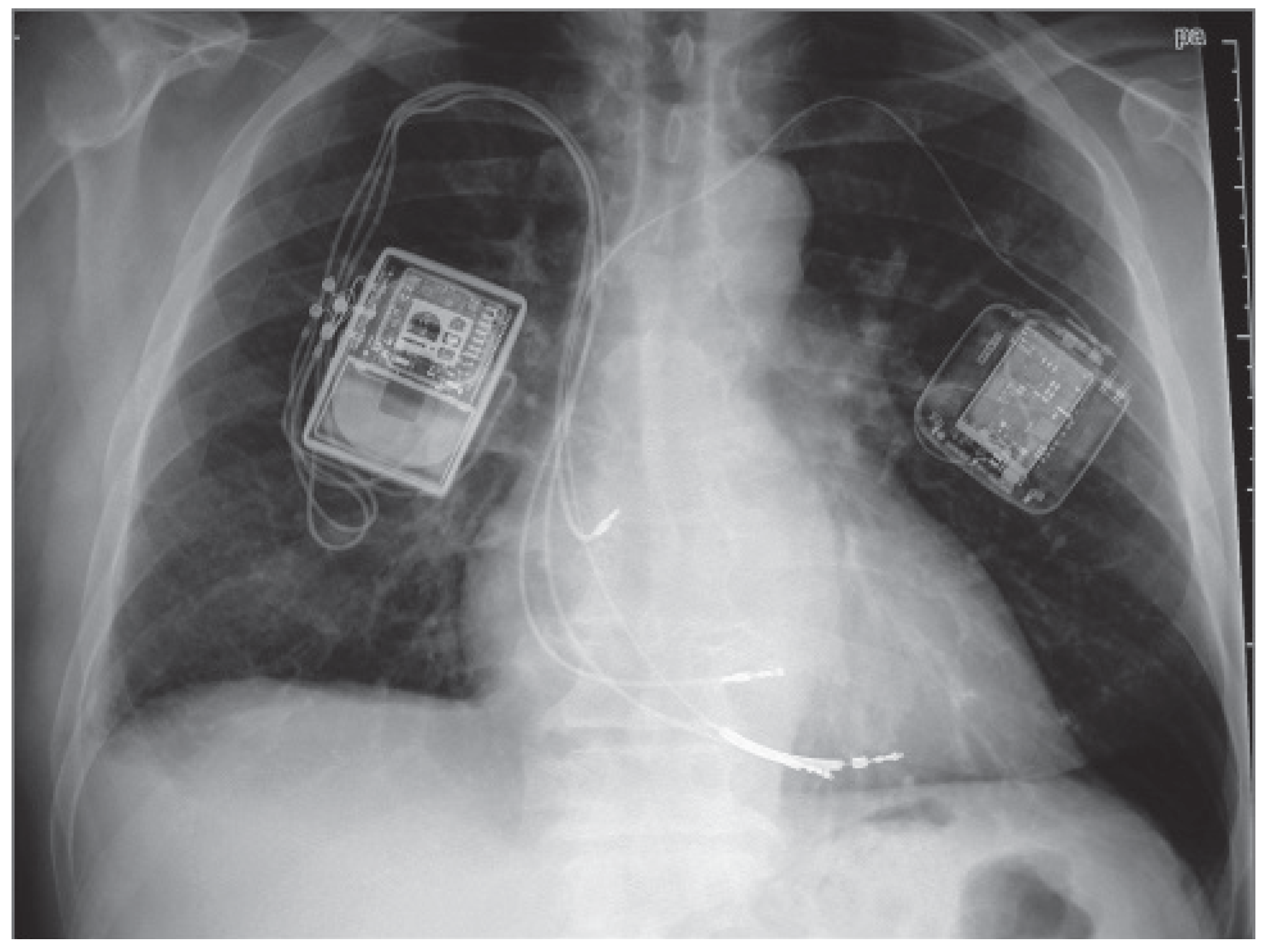 Cardiovascmed 16 00259 g003 Cardiovascmed 16 00259 g003