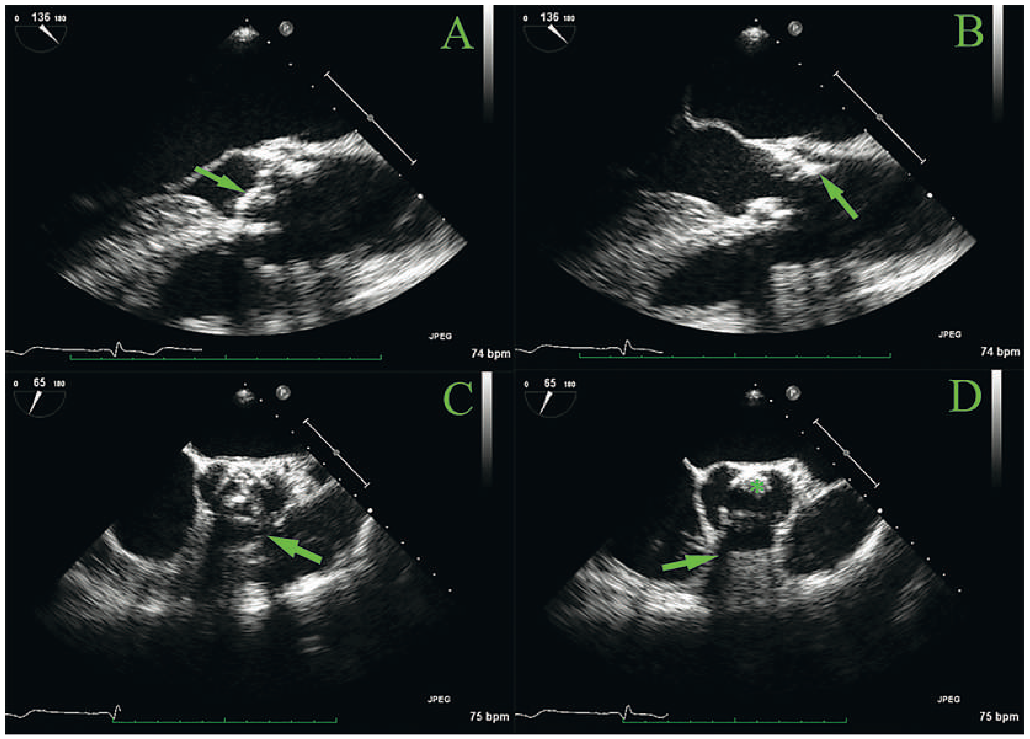 Cardiovascmed 16 00303 g001