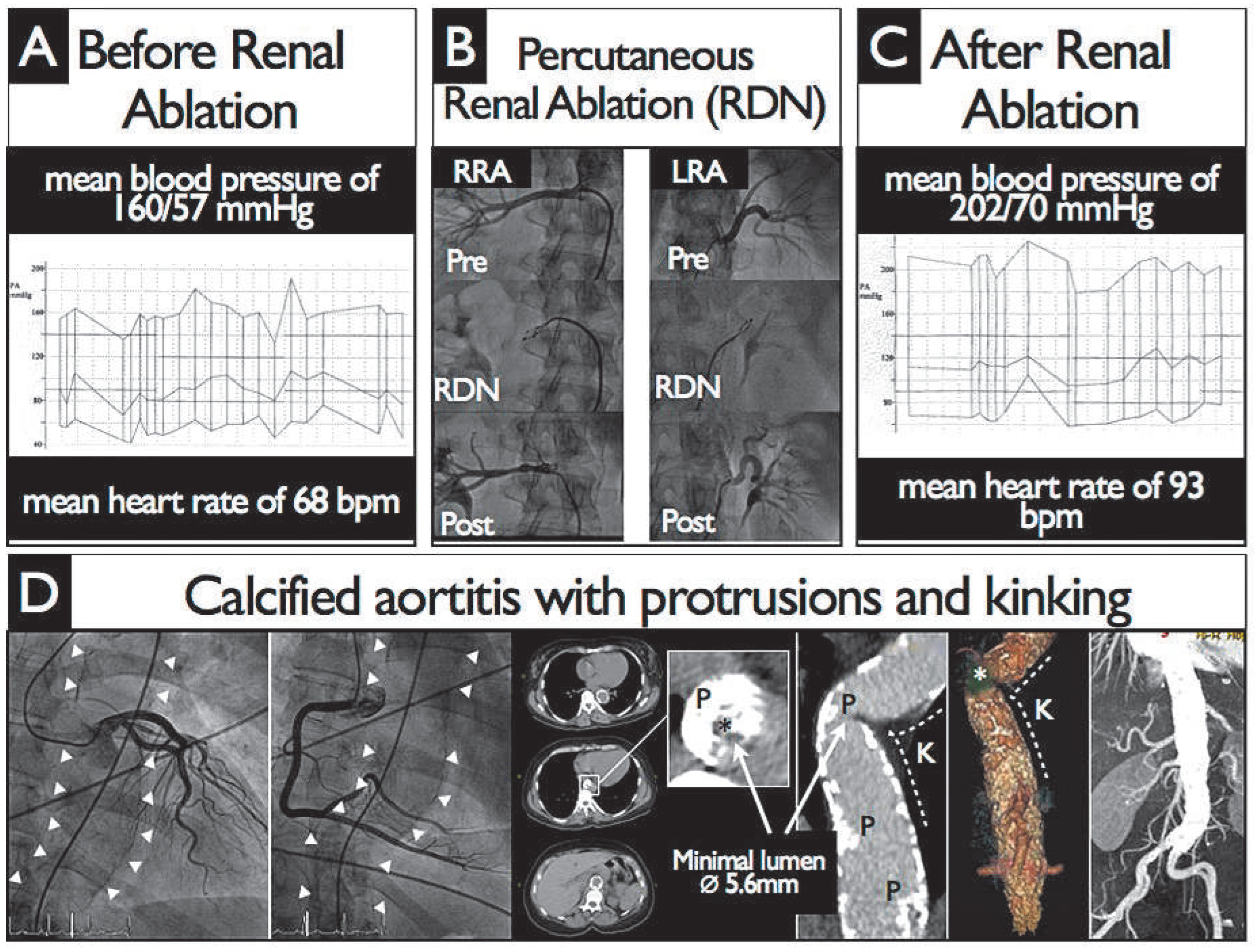 Cardiovascmed 16 00329 g001