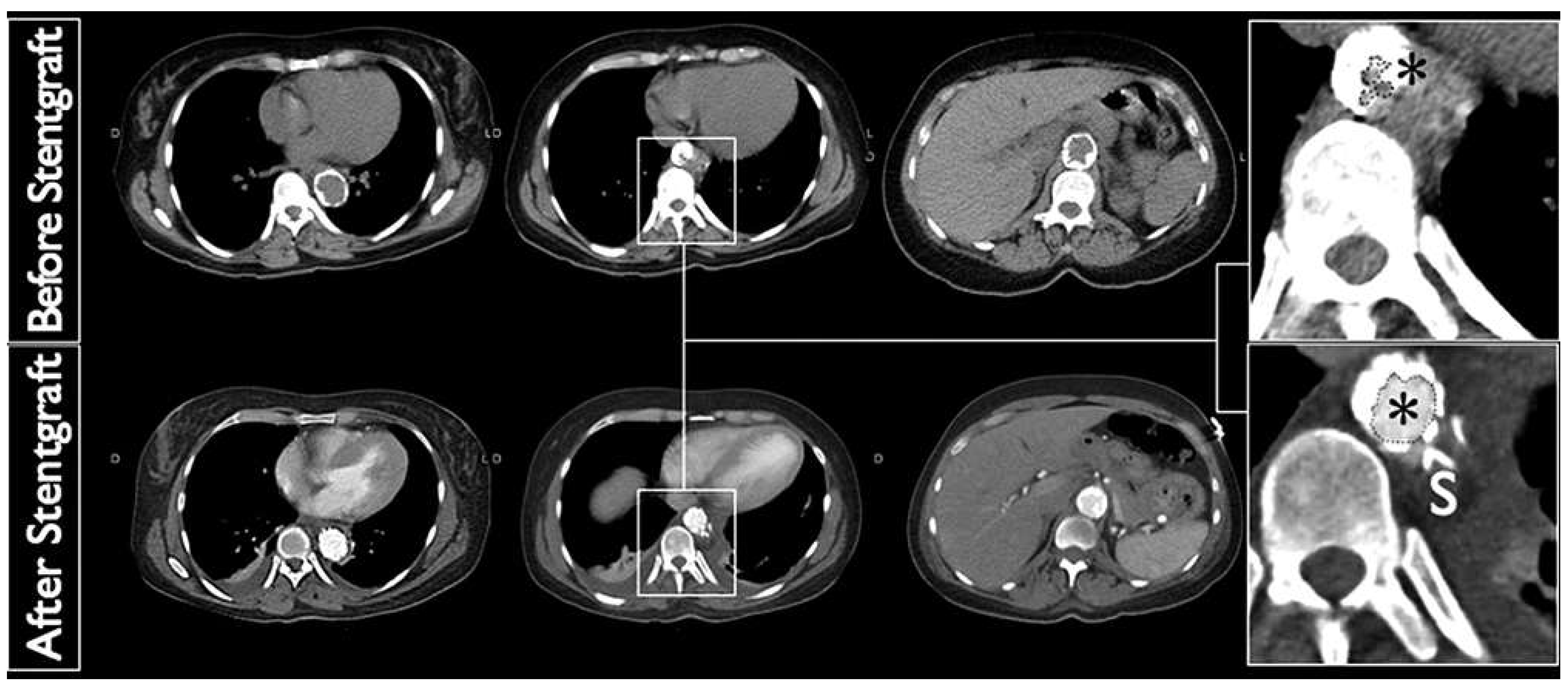 Cardiovascmed 16 00329 g002