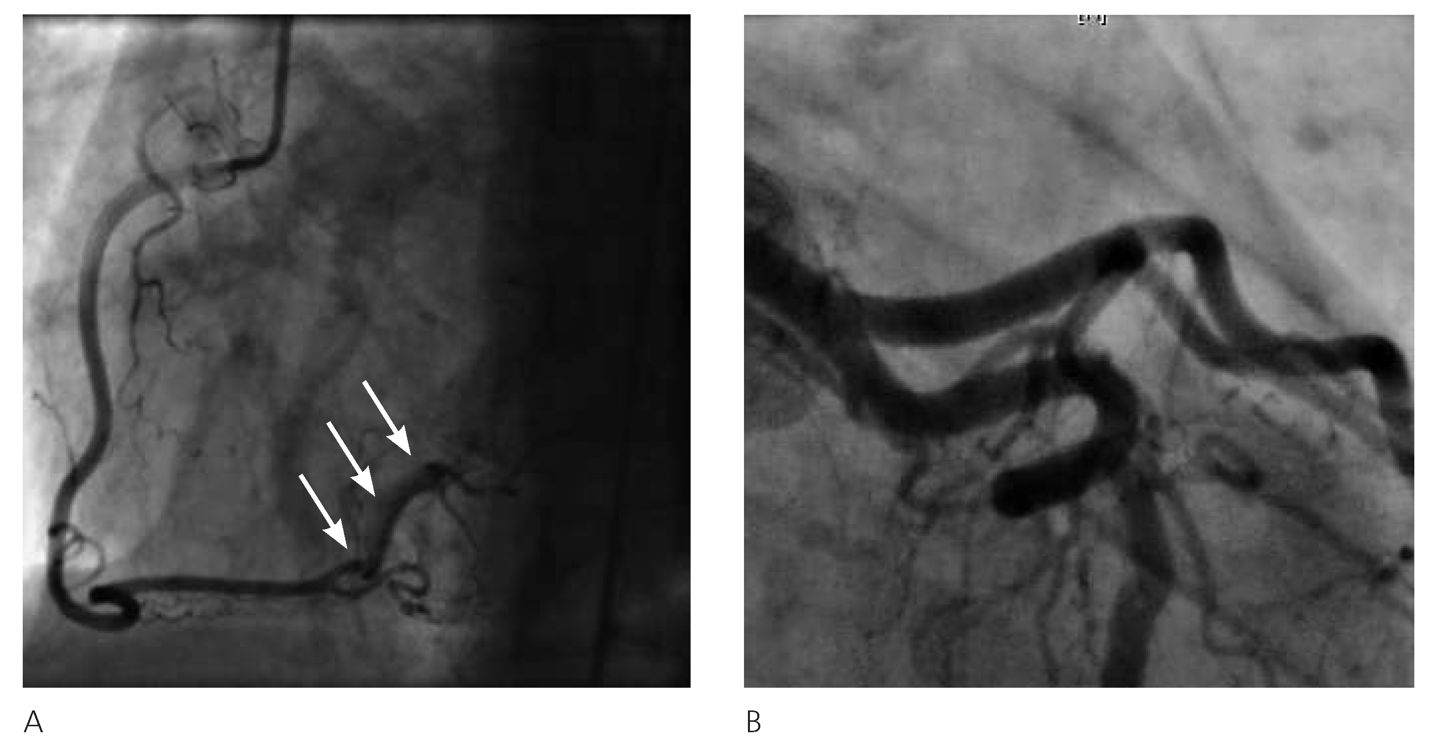 Cardiovascmed 17 00001 g003