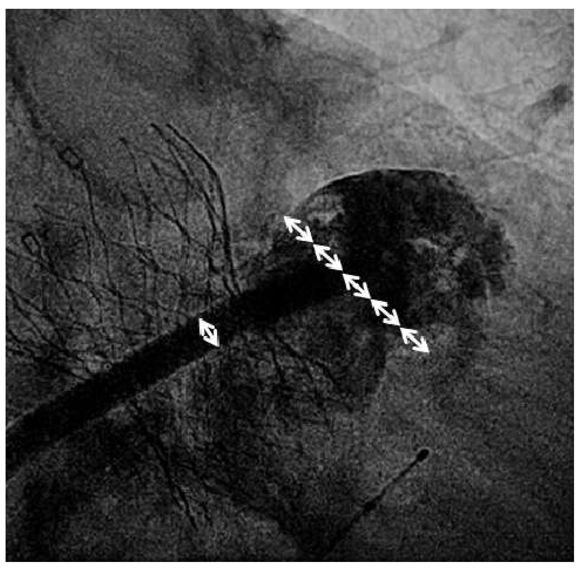 Cardiovascmed 17 00021 g001