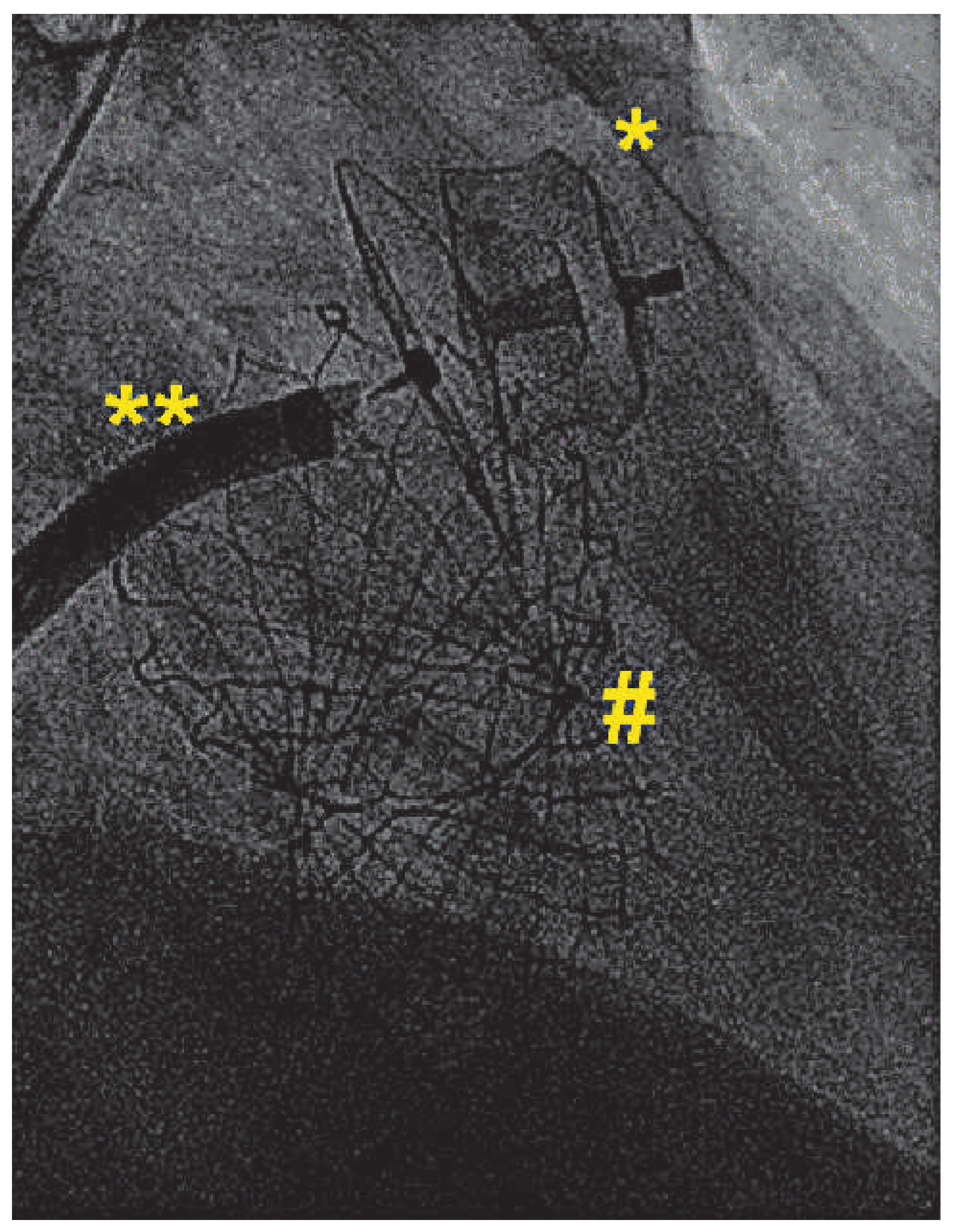 Cardiovascmed 17 00021 g002