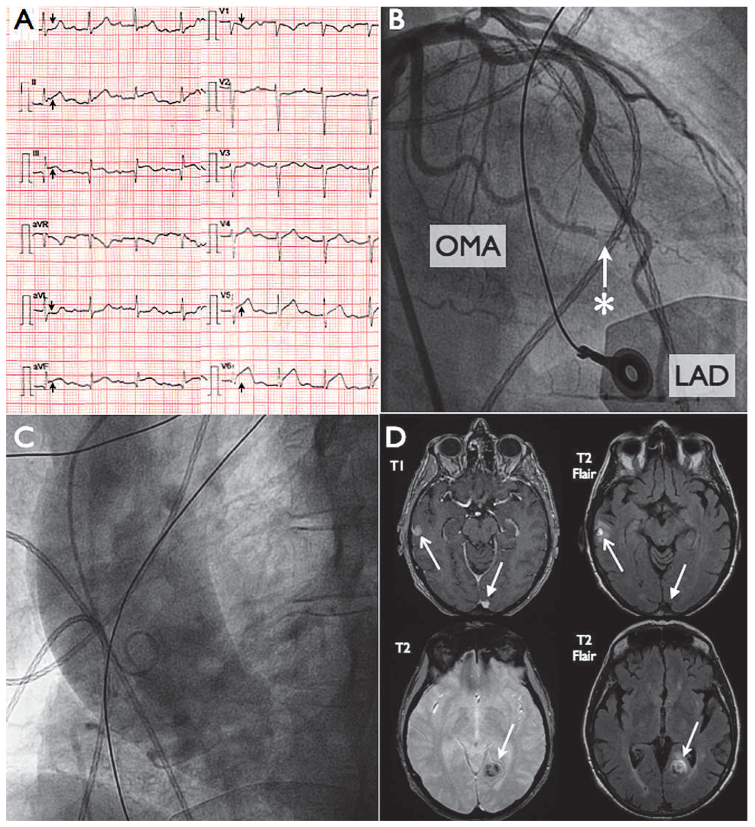 Cardiovascmed 17 00024 g001 Cardiovascmed 17 00024 g001