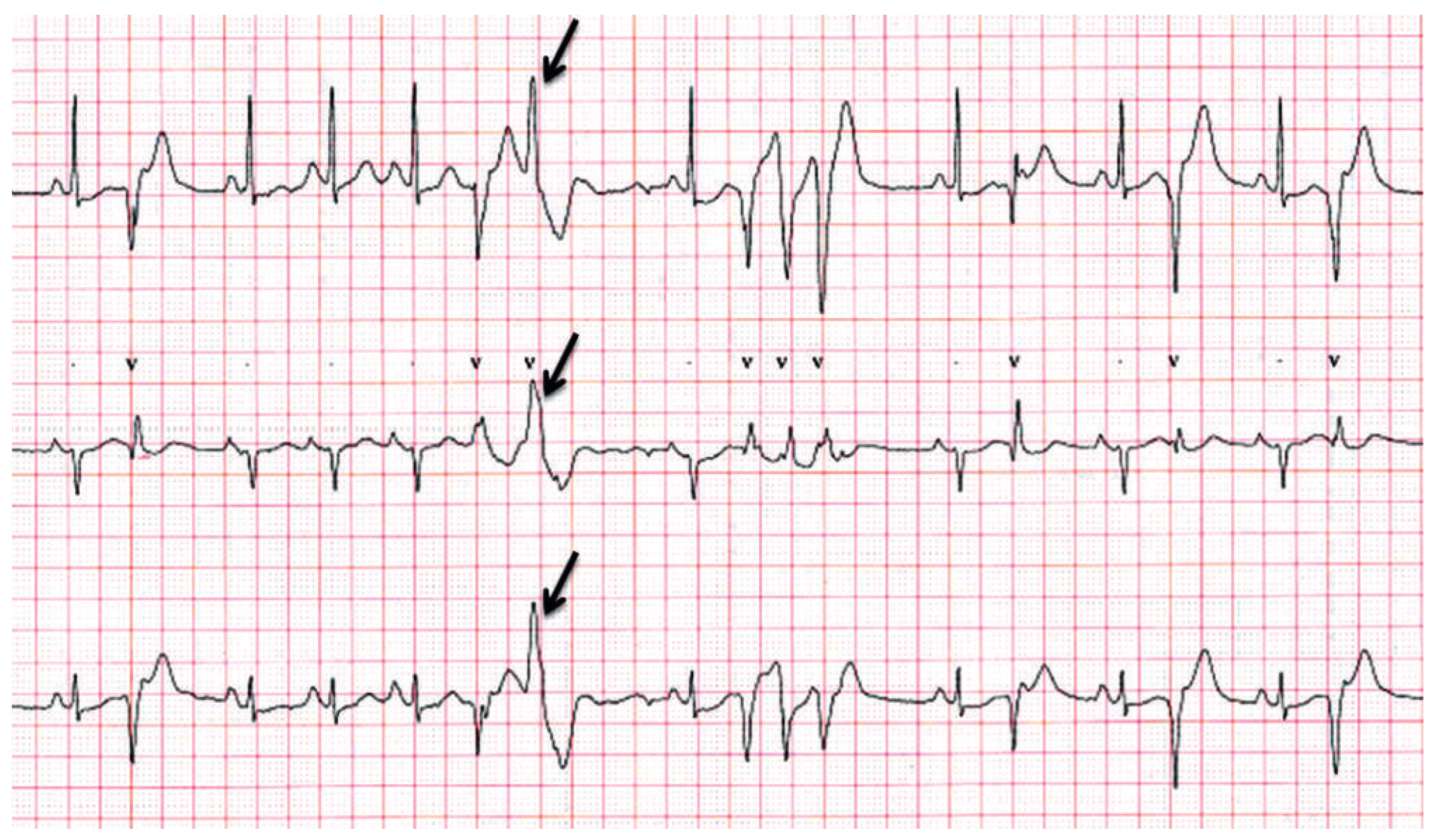 Cardiovascmed 17 00027 g003 Cardiovascmed 17 00027 g003
