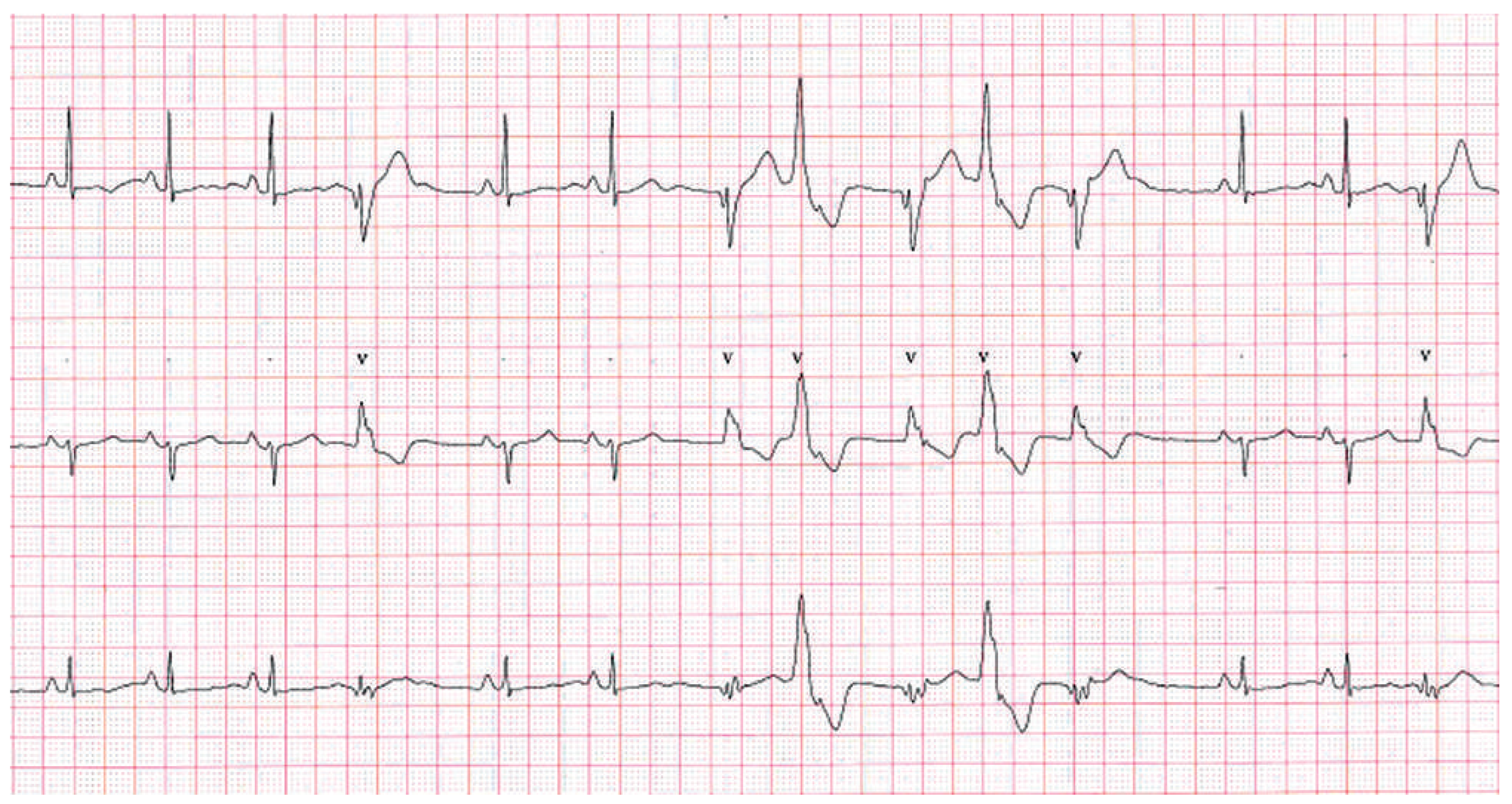 Cardiovascmed 17 00027 g004 Cardiovascmed 17 00027 g004