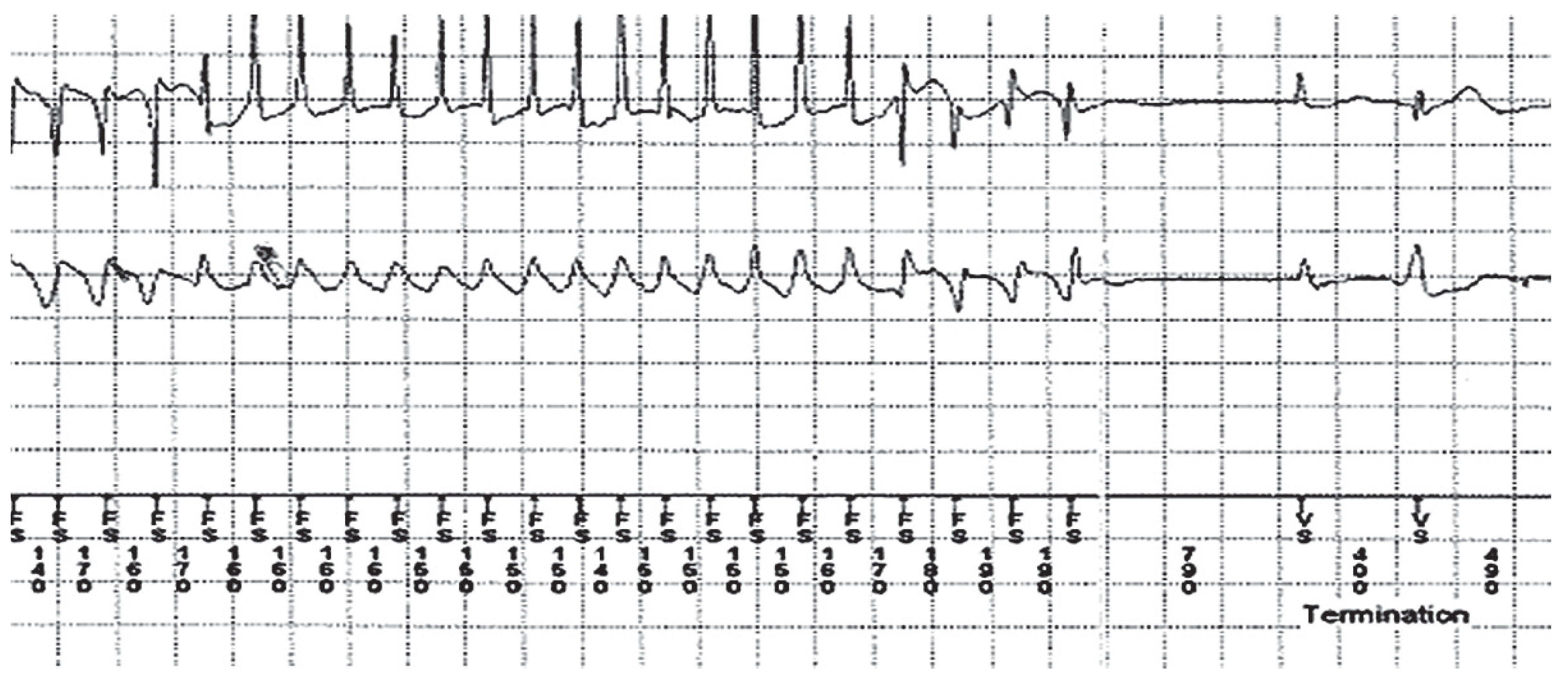 Cardiovascmed 17 00027 g005 Cardiovascmed 17 00027 g005