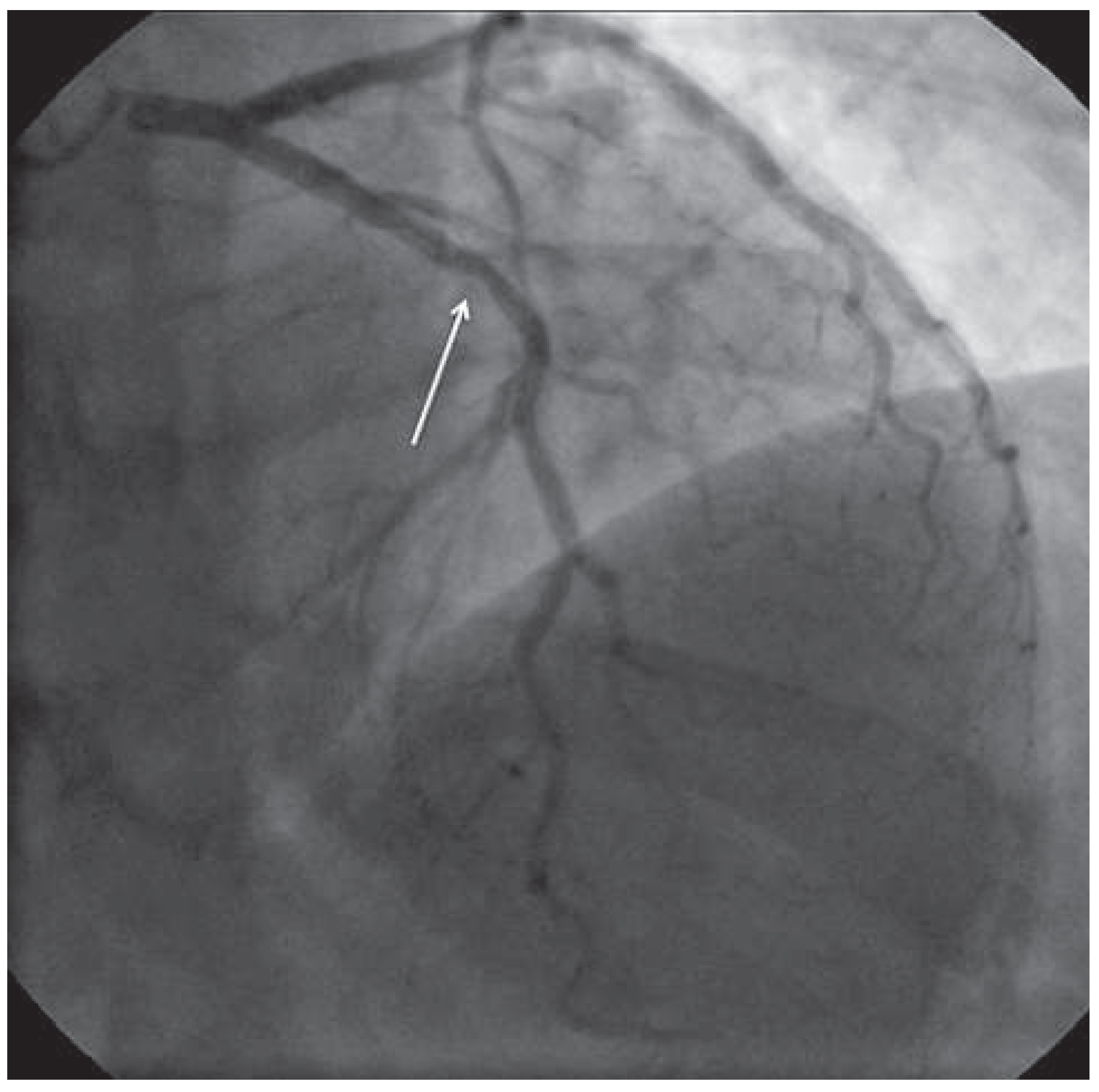 Cardiovascmed 17 00046 g001 Cardiovascmed 17 00046 g001