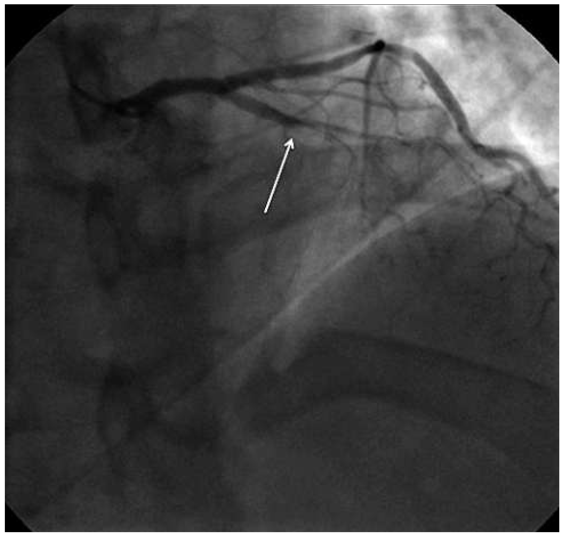 Cardiovascmed 17 00046 g002 Cardiovascmed 17 00046 g002