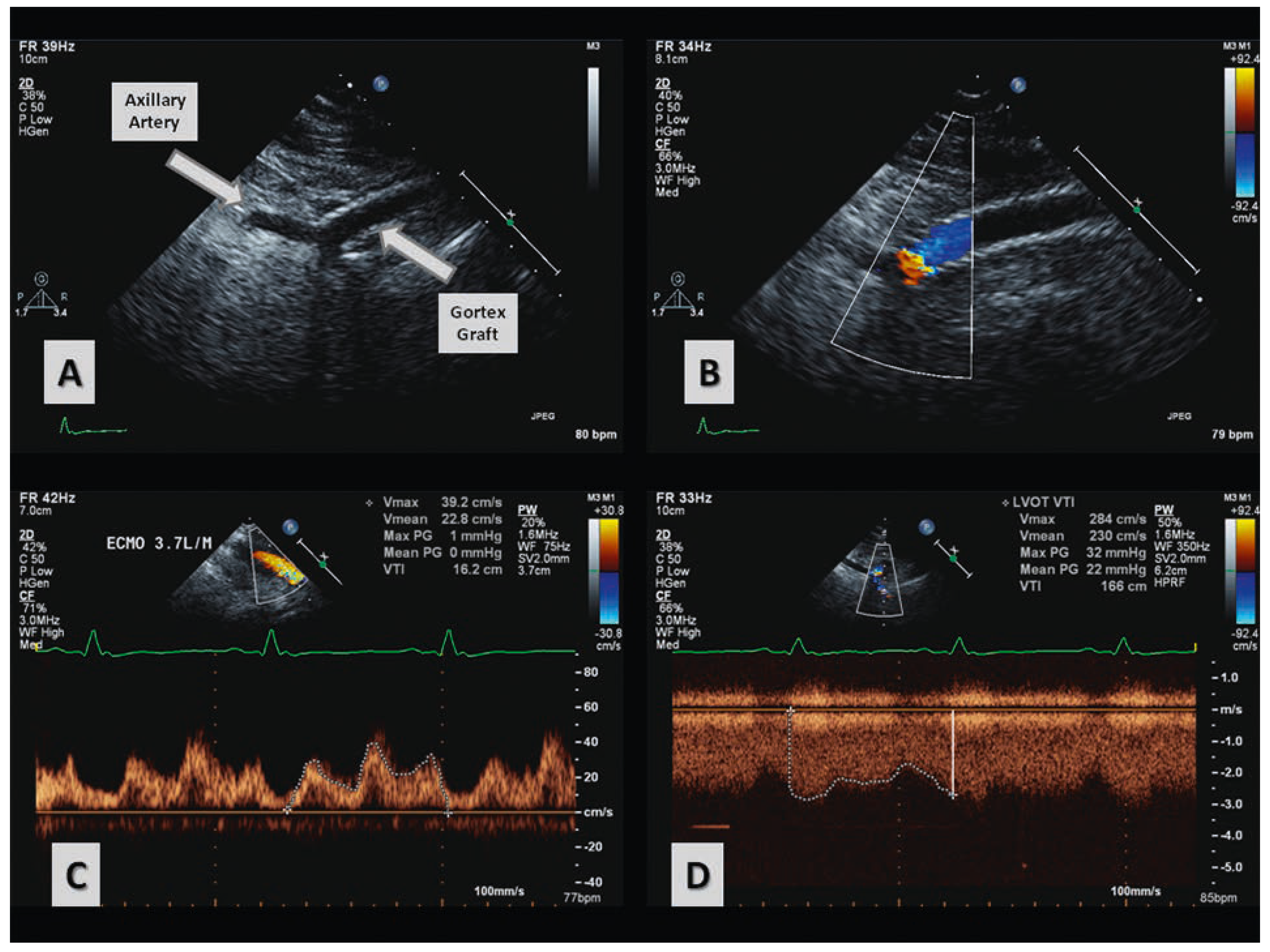 Cardiovascmed 17 00048 g001 Cardiovascmed 17 00048 g001