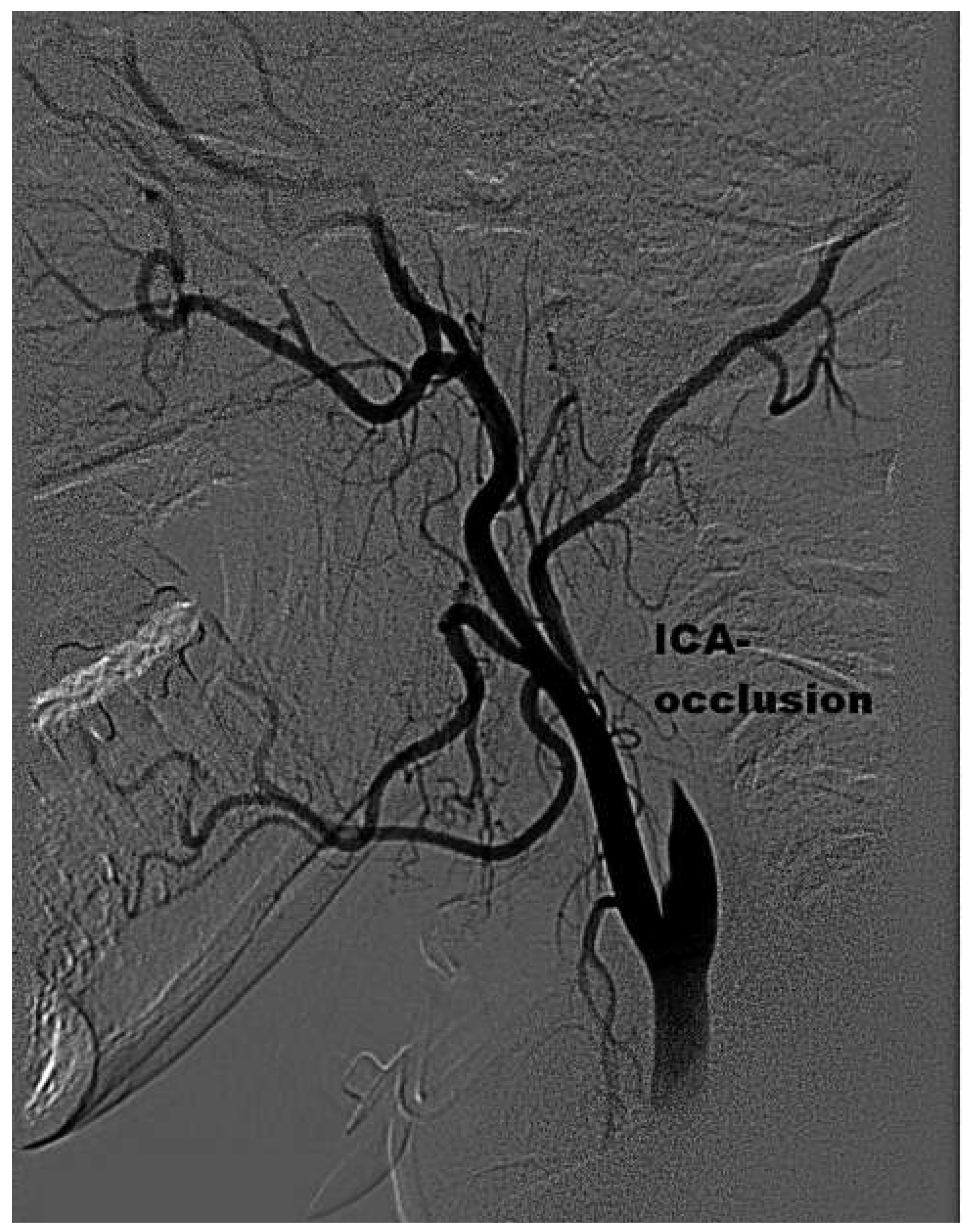 Cardiovascmed 17 00051 g002 Cardiovascmed 17 00051 g002