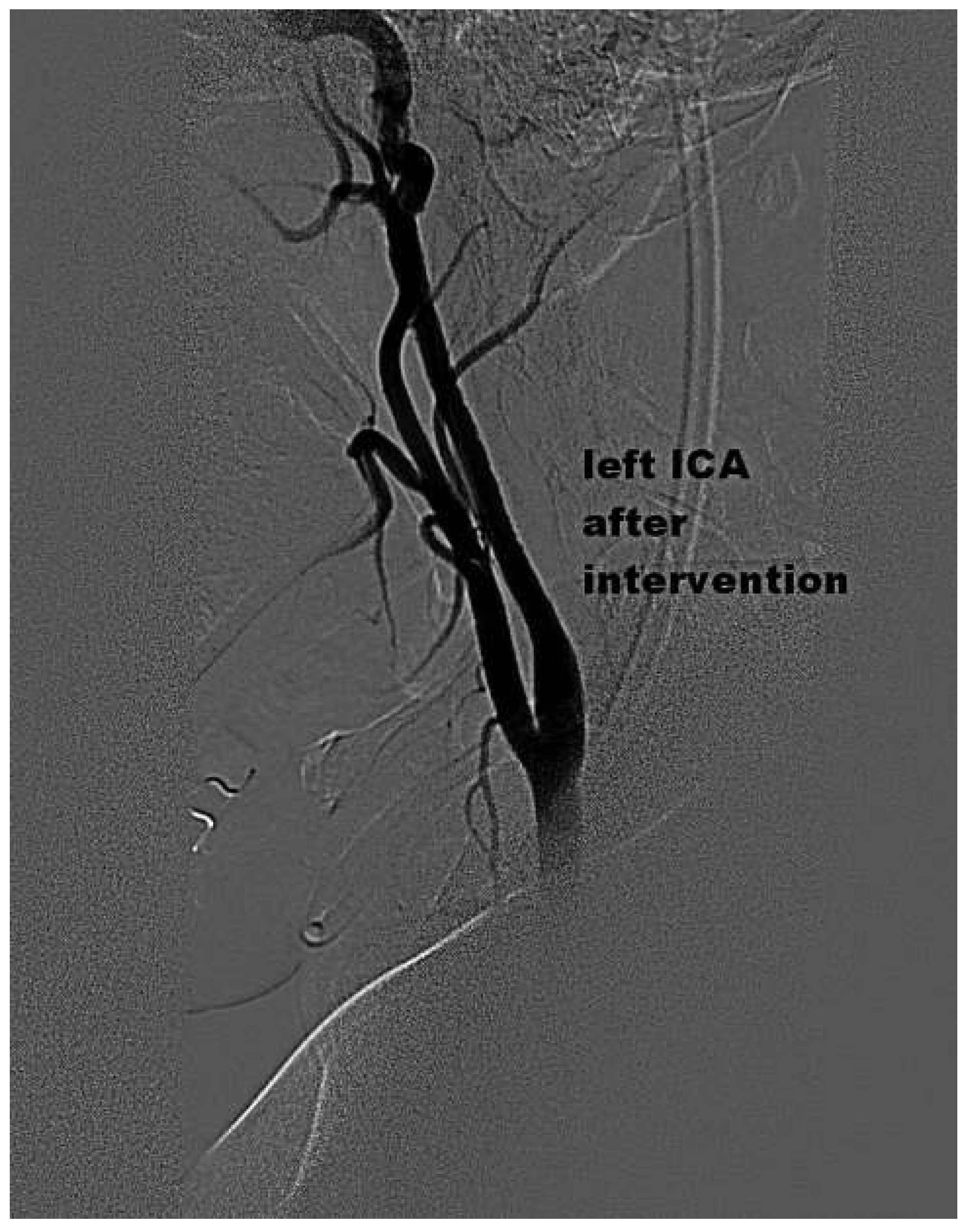 Cardiovascmed 17 00051 g003 Cardiovascmed 17 00051 g003