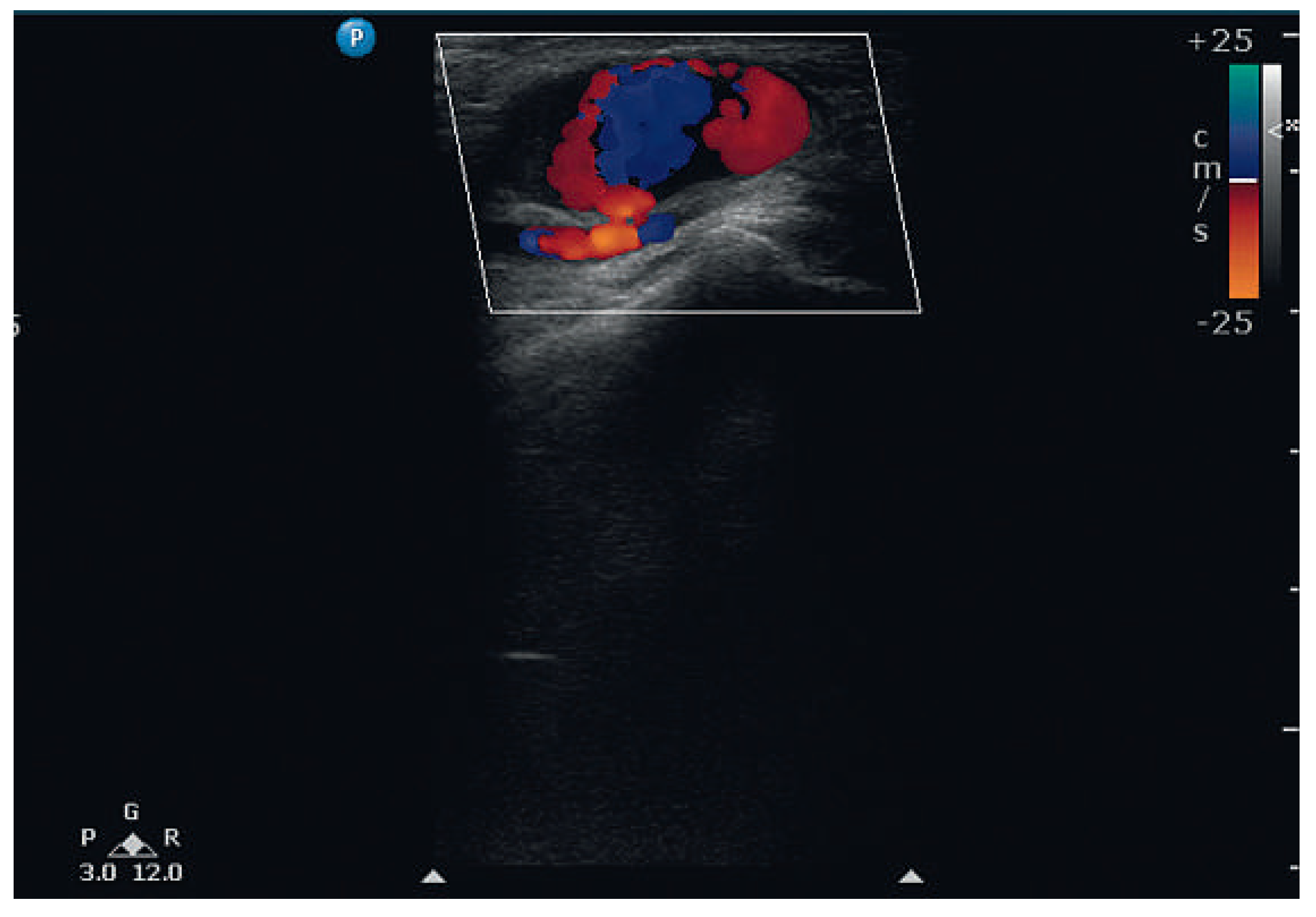 Cardiovascmed 17 00054 g002 Cardiovascmed 17 00054 g002