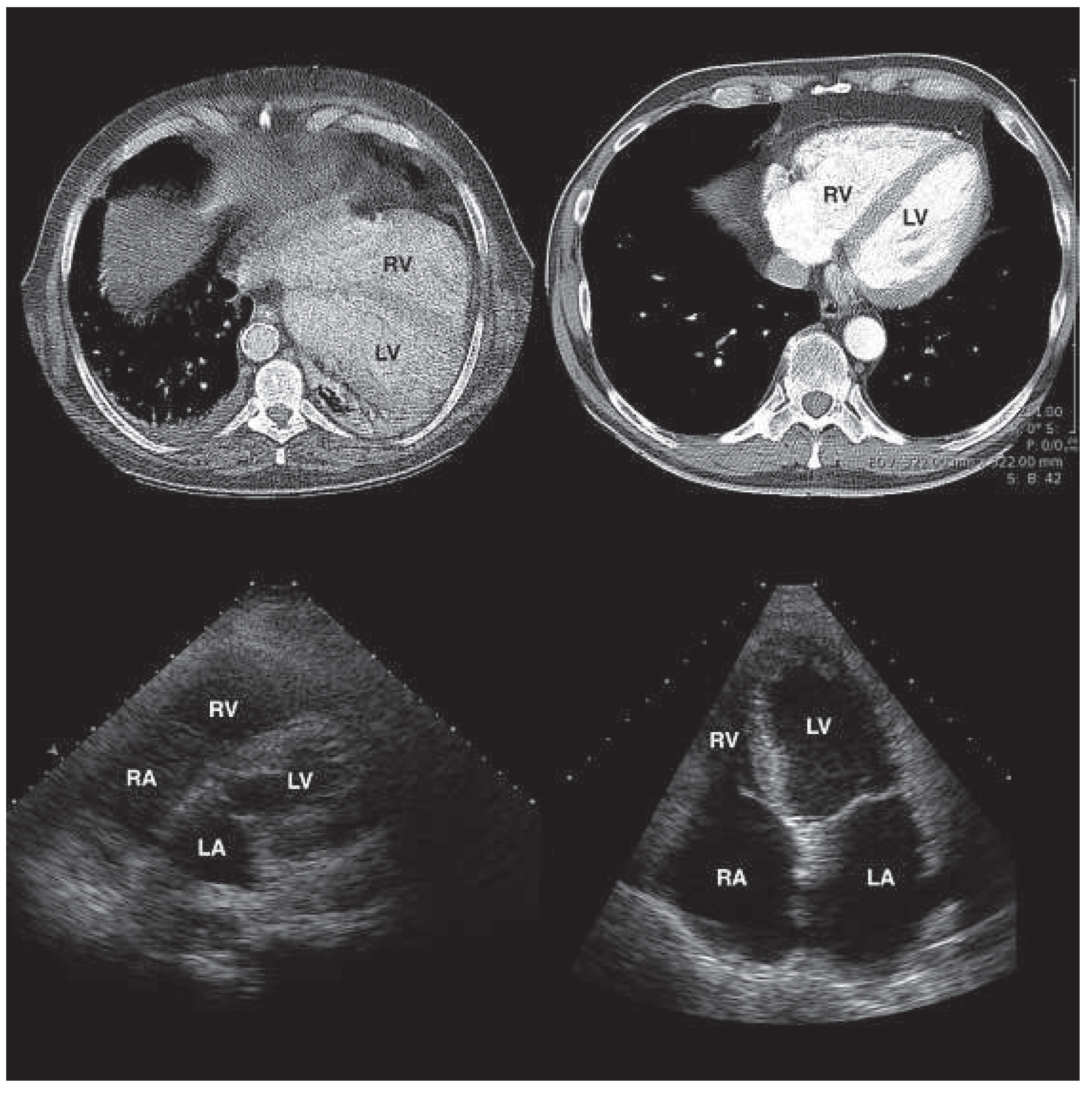 Cardiovascmed 17 00055 g001 Cardiovascmed 17 00055 g001