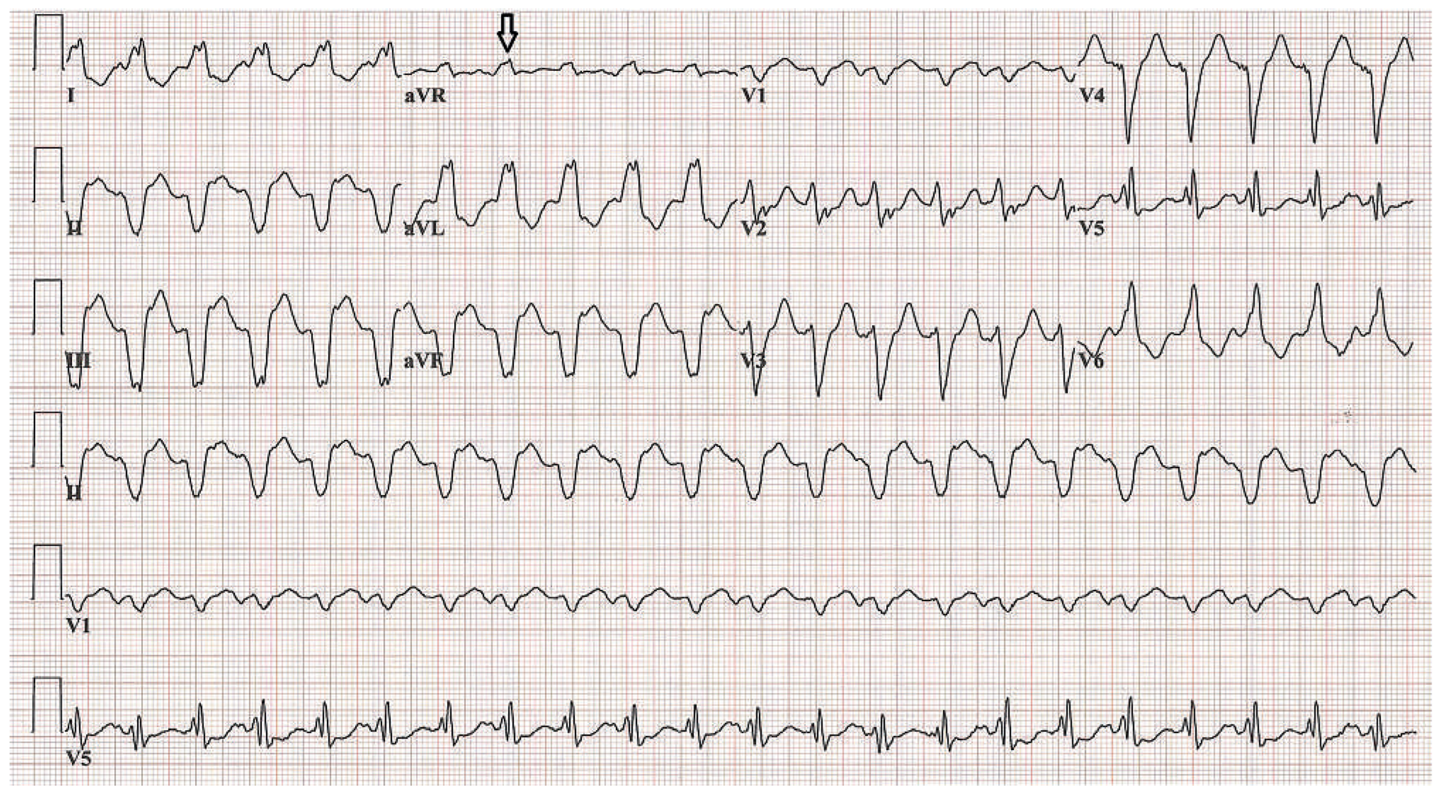 Cardiovascmed 17 00088 g001