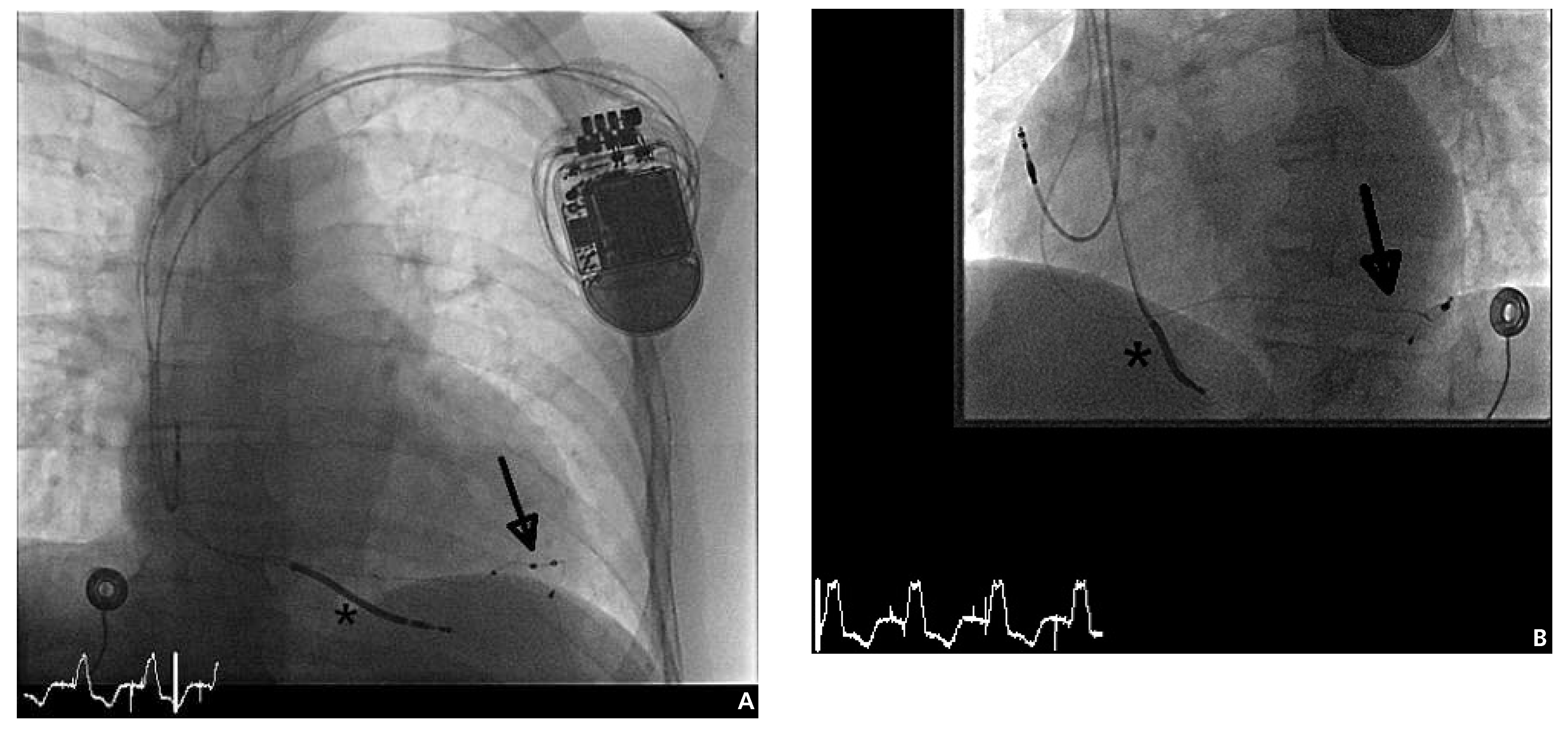 Cardiovascmed 17 00091 g002