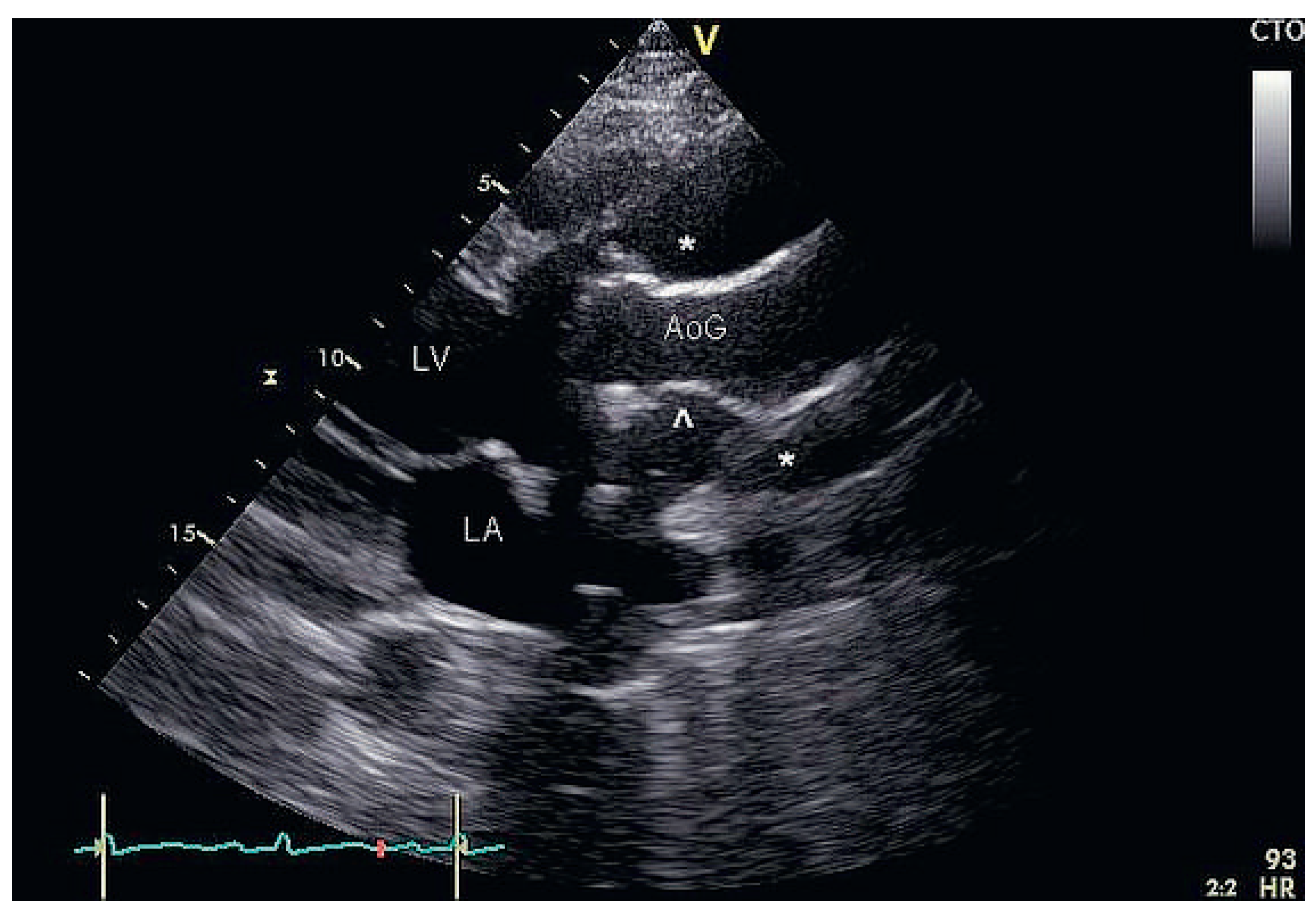 Cardiovascmed 17 00095 g001 Cardiovascmed 17 00095 g001