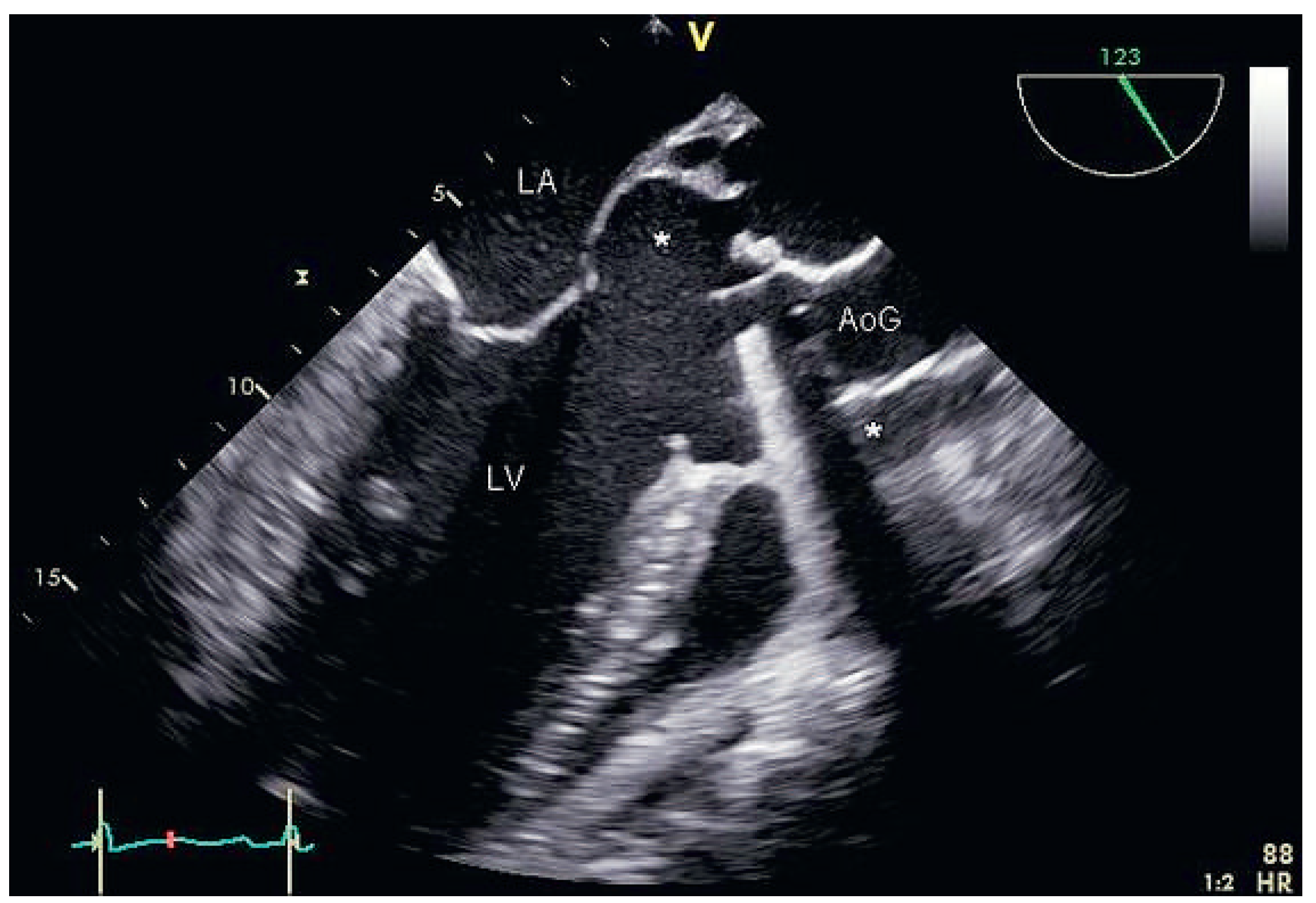 Cardiovascmed 17 00095 g002 Cardiovascmed 17 00095 g002