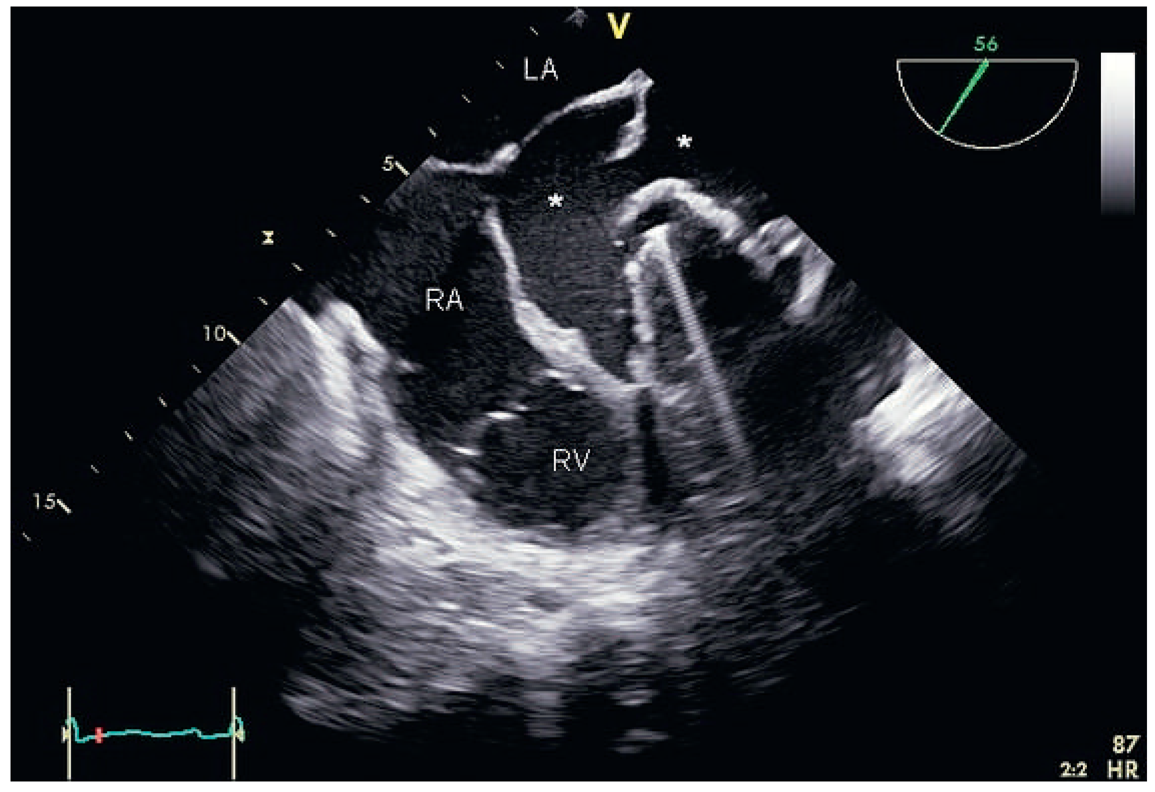 Cardiovascmed 17 00095 g003 Cardiovascmed 17 00095 g003