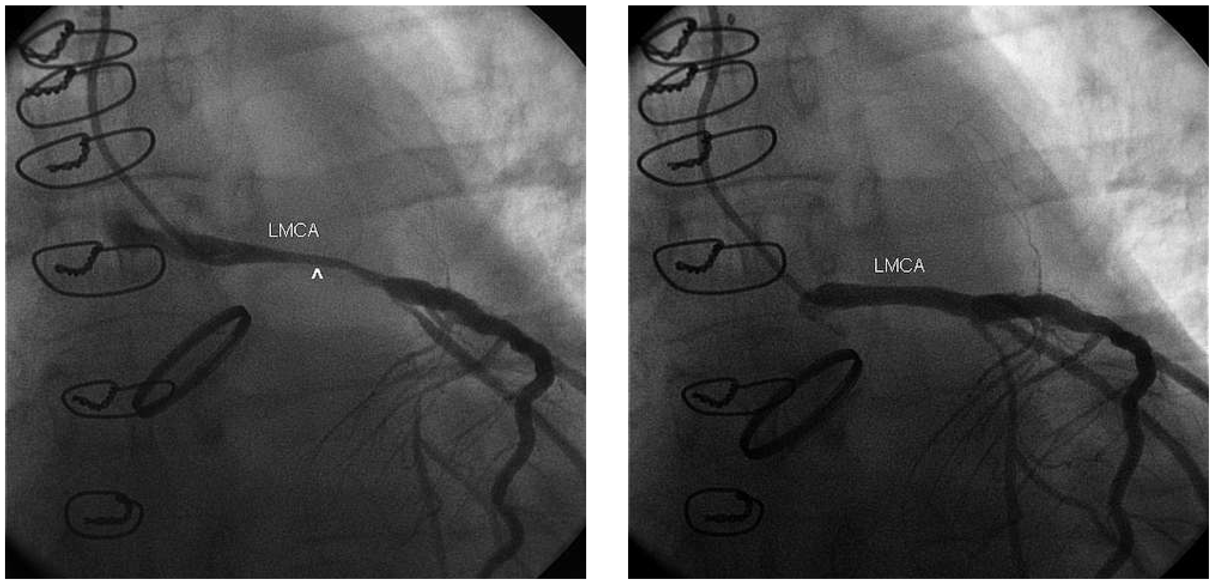 Cardiovascmed 17 00095 g004 Cardiovascmed 17 00095 g004
