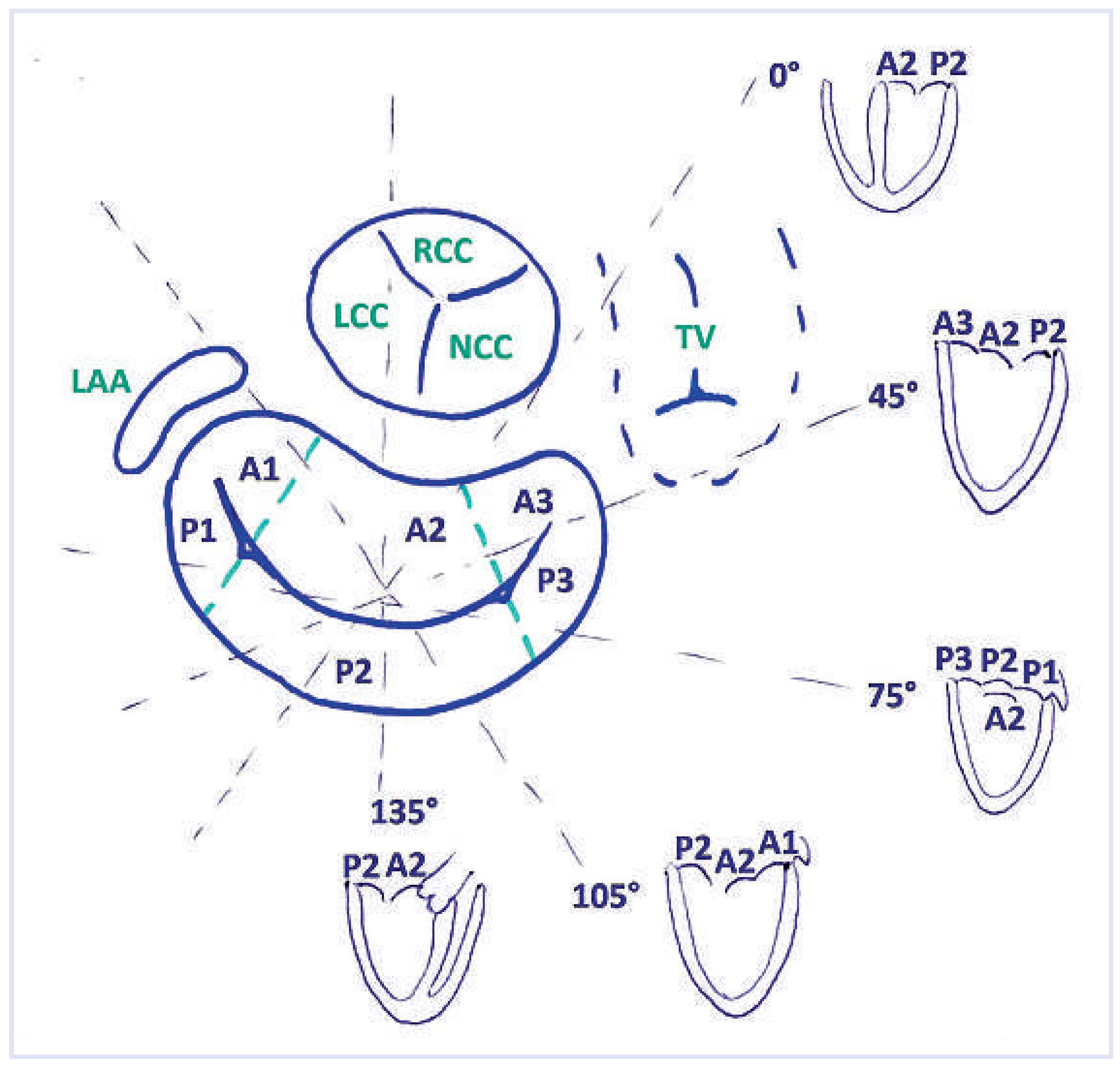 Cardiovascmed 17 00101 g002