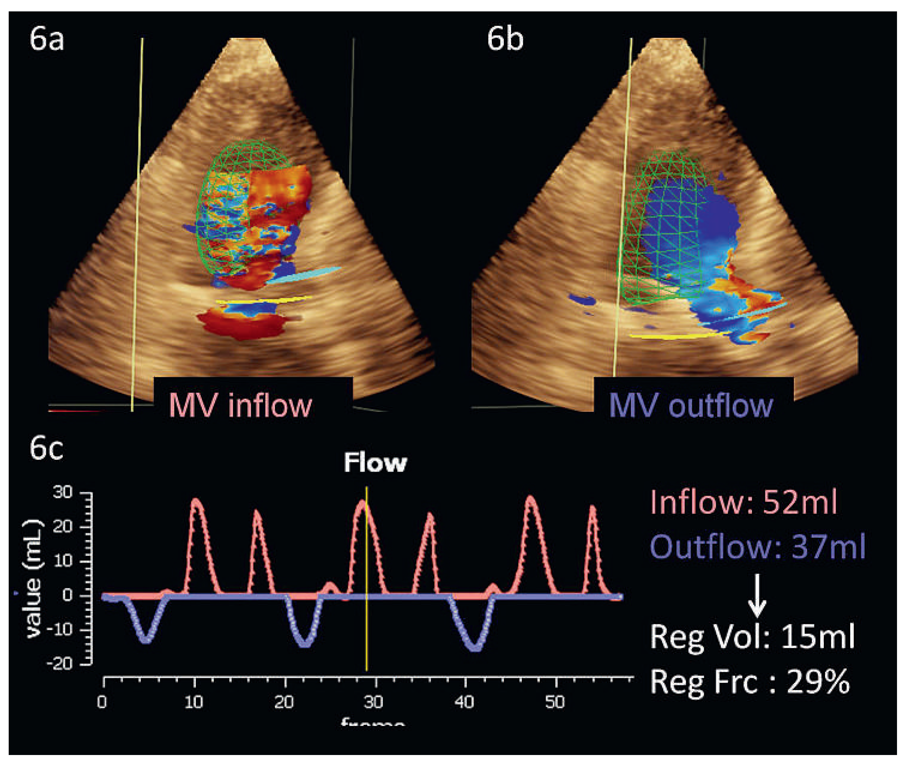 Cardiovascmed 17 00101 g006