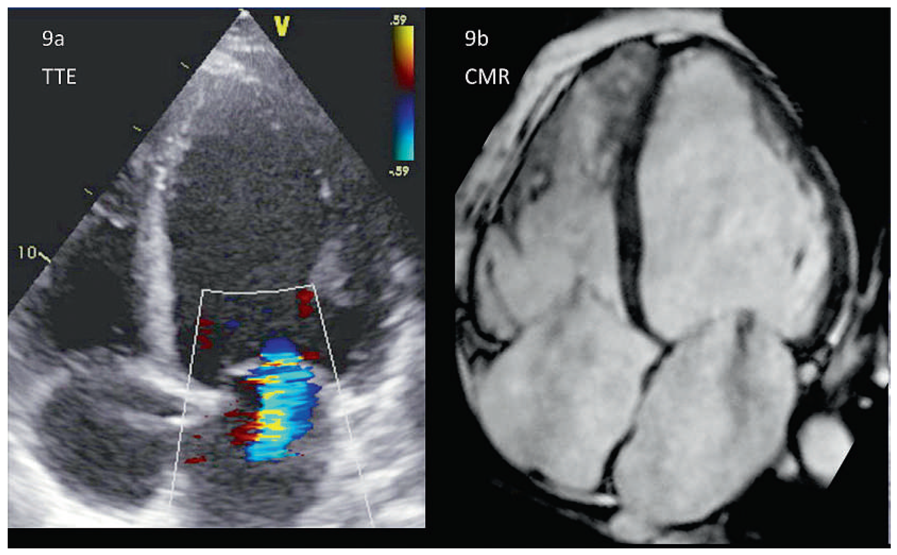 Cardiovascmed 17 00101 g009