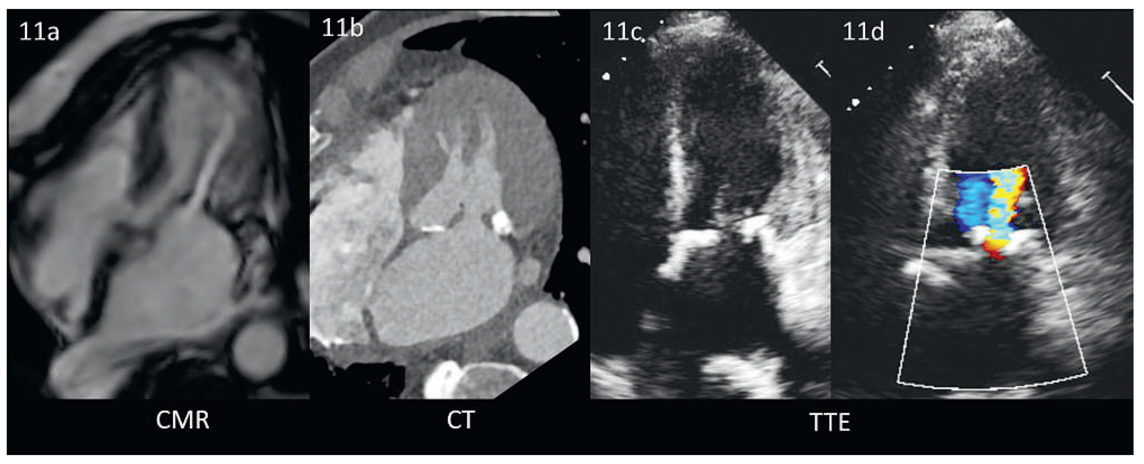 Cardiovascmed 17 00101 g011
