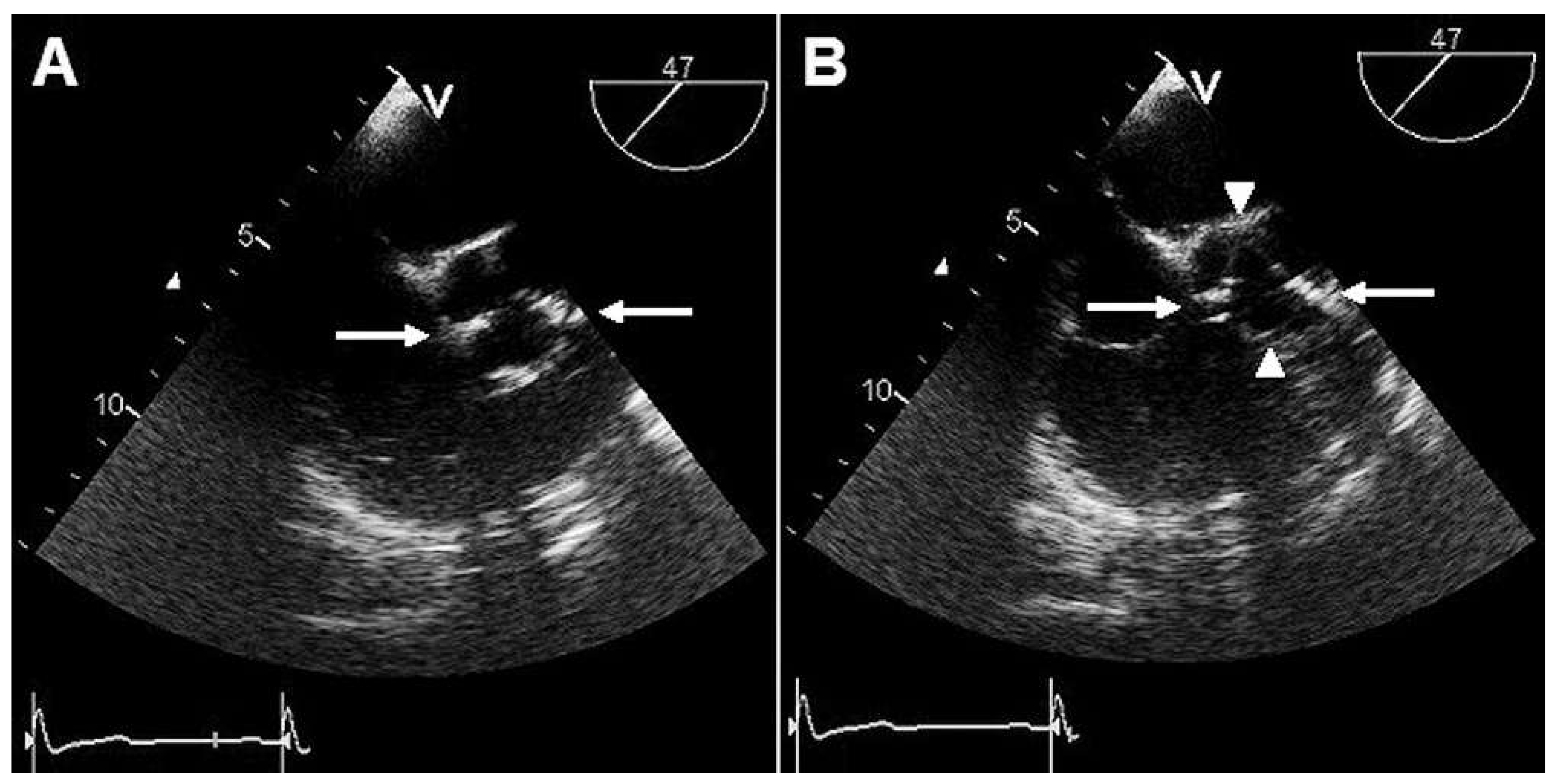 Cardiovascmed 17 00115 g001