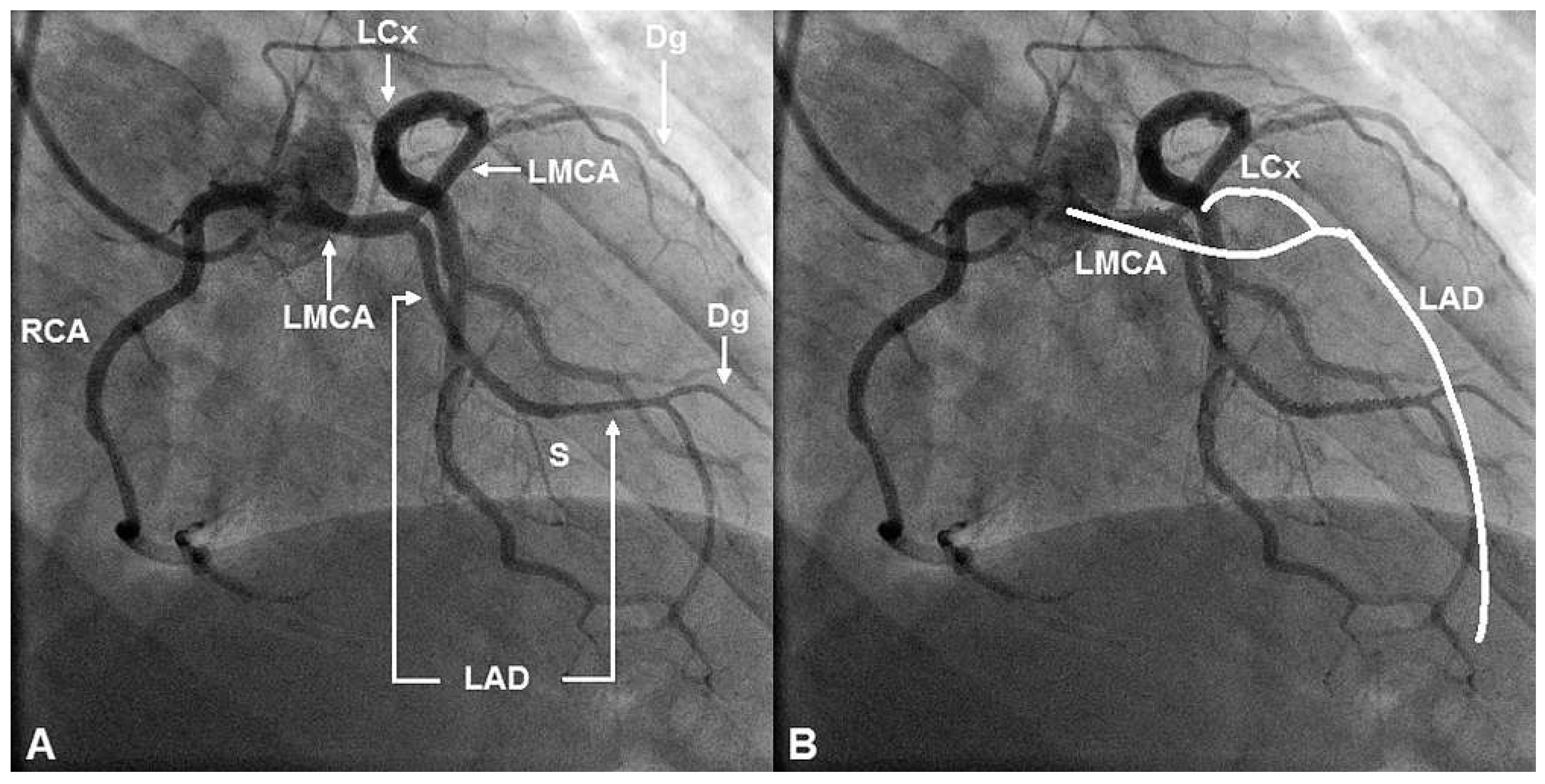Cardiovascmed 17 00115 g002