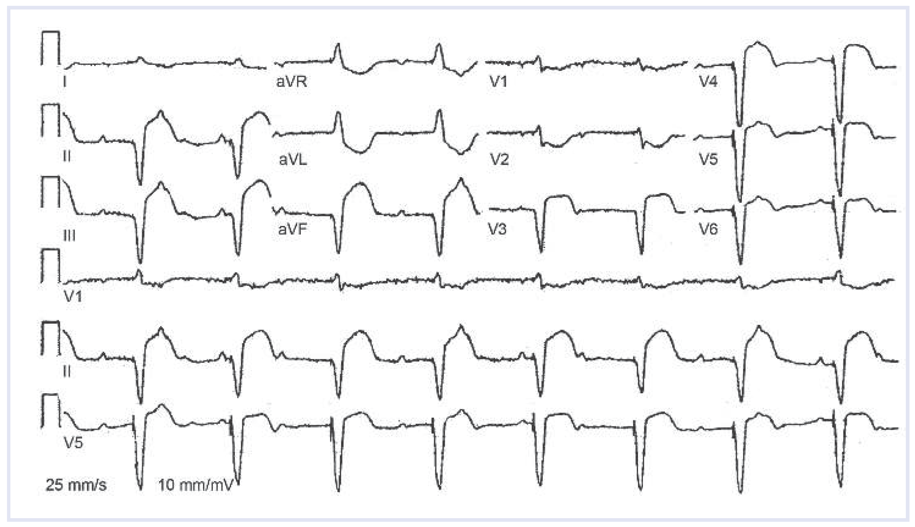 Cardiovascmed 17 00118 g001