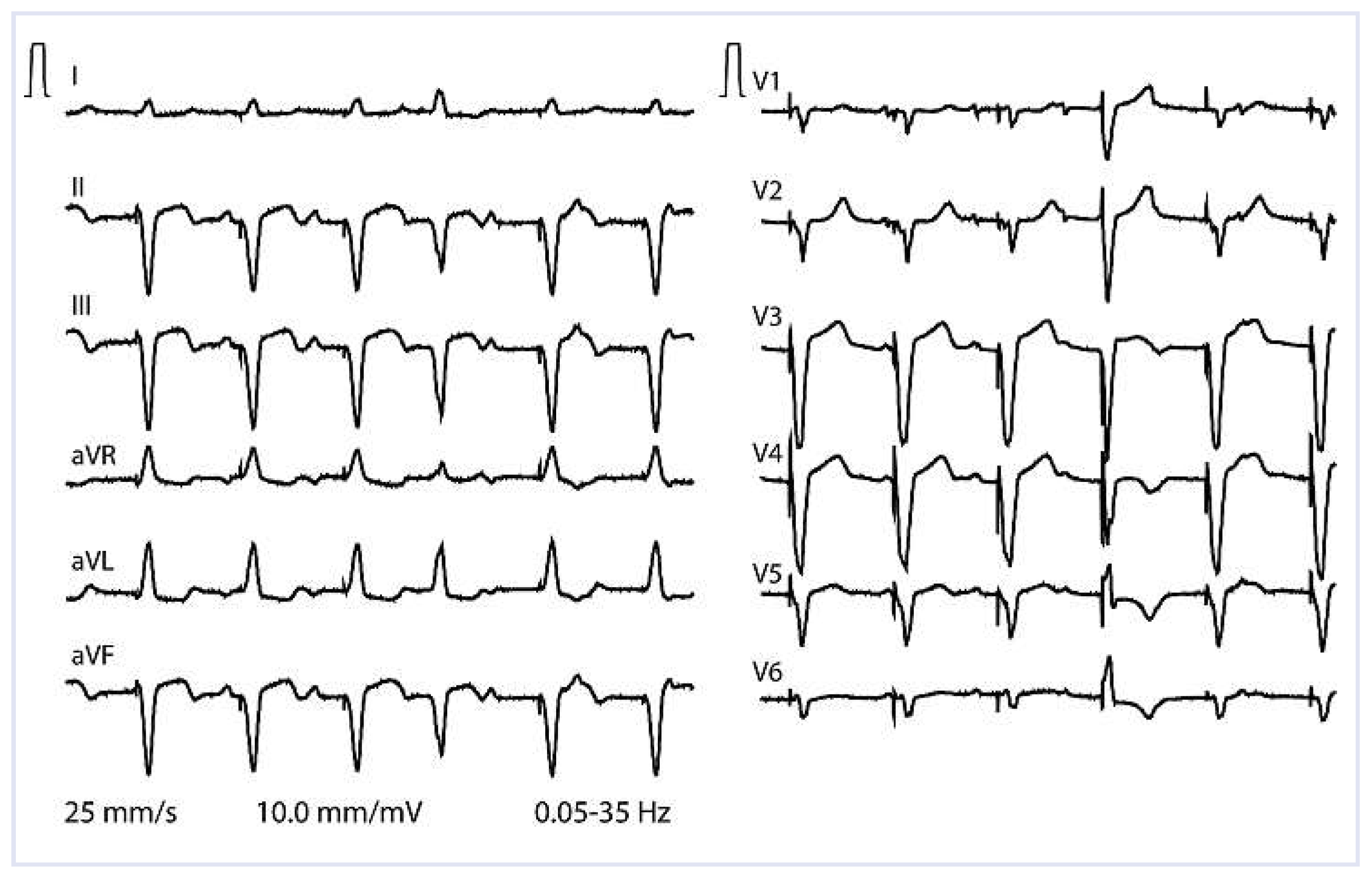 Cardiovascmed 17 00118 g003