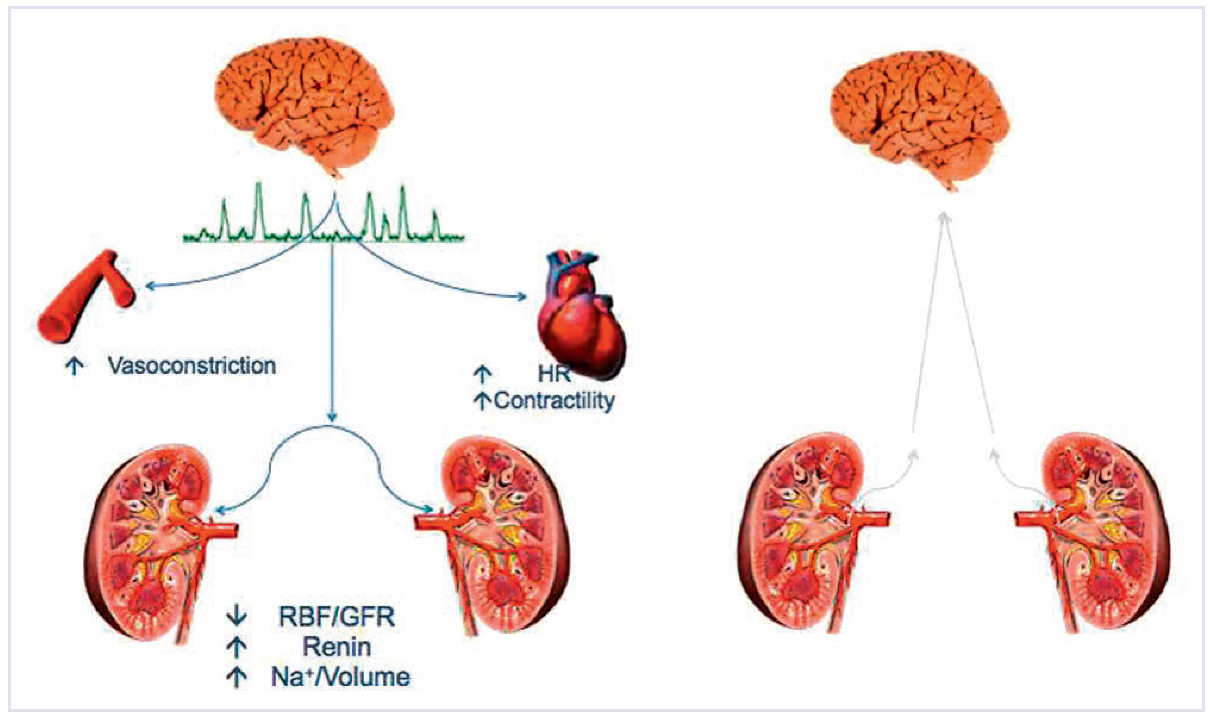 Cardiovascmed 17 00129 g001 Cardiovascmed 17 00129 g001