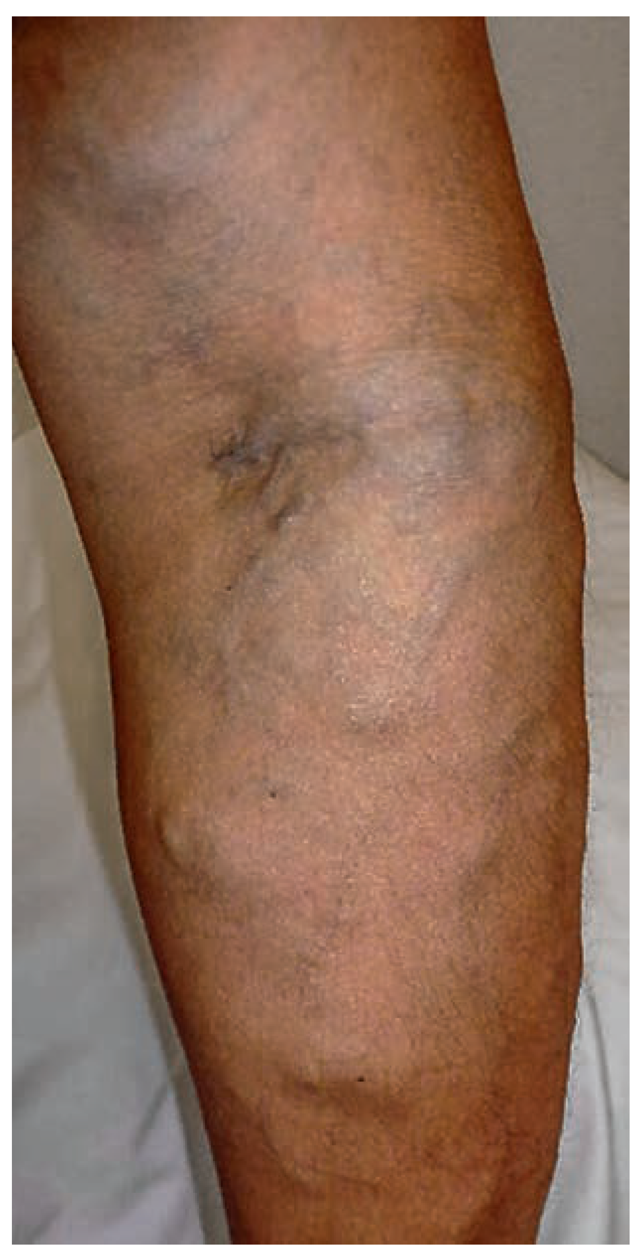 Cardiovascmed 17 00133 g001 Cardiovascmed 17 00133 g001