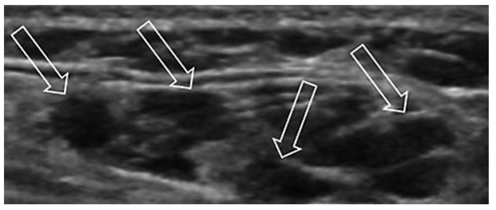 Cardiovascmed 17 00133 g003 Cardiovascmed 17 00133 g003