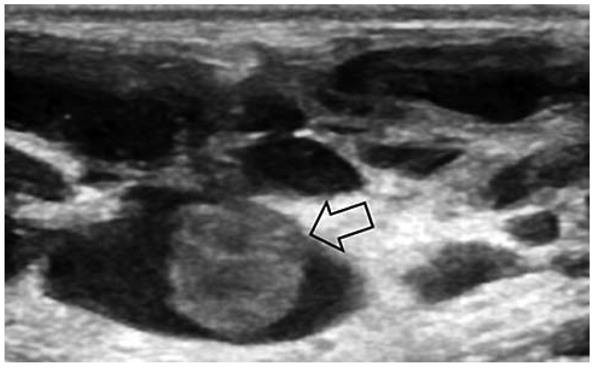 Cardiovascmed 17 00133 g004 Cardiovascmed 17 00133 g004