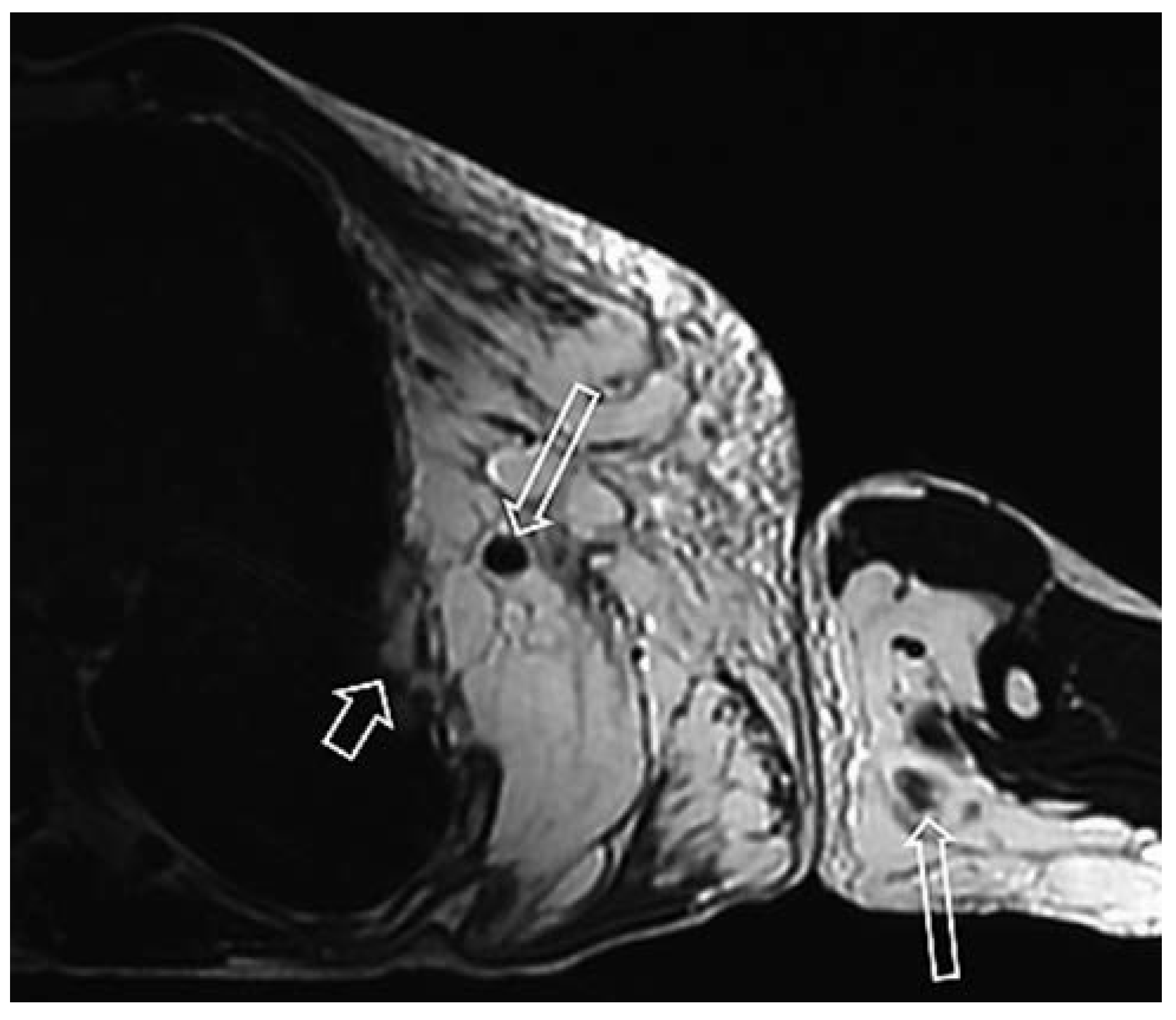 Cardiovascmed 17 00133 g005 Cardiovascmed 17 00133 g005