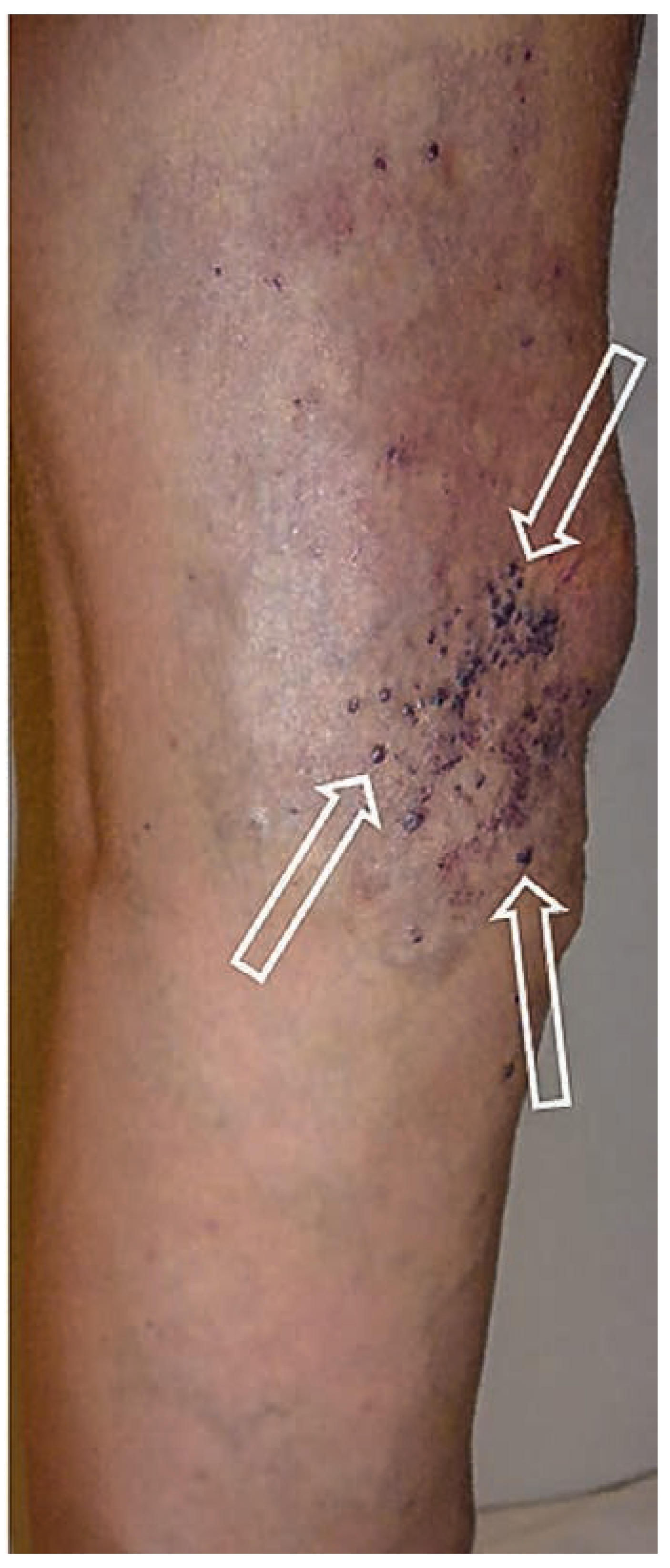 Cardiovascmed 17 00133 g007 Cardiovascmed 17 00133 g007