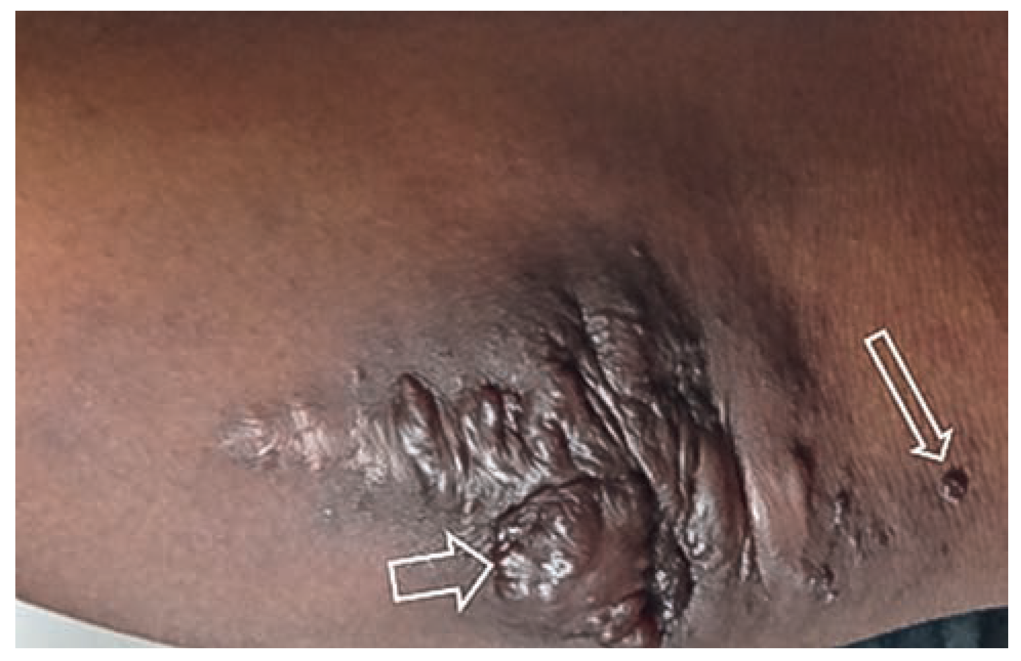 Cardiovascmed 17 00133 g008 Cardiovascmed 17 00133 g008