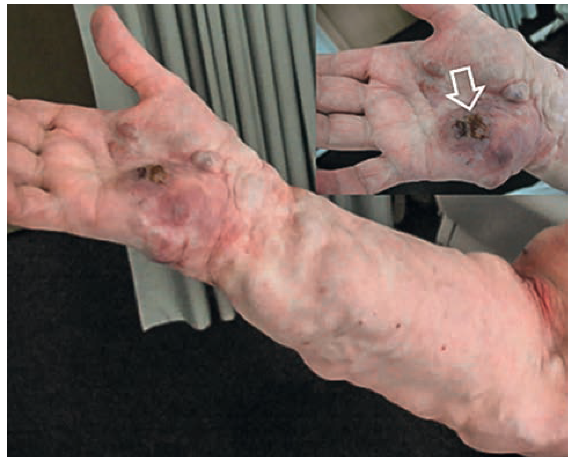 Cardiovascmed 17 00133 g011 Cardiovascmed 17 00133 g011