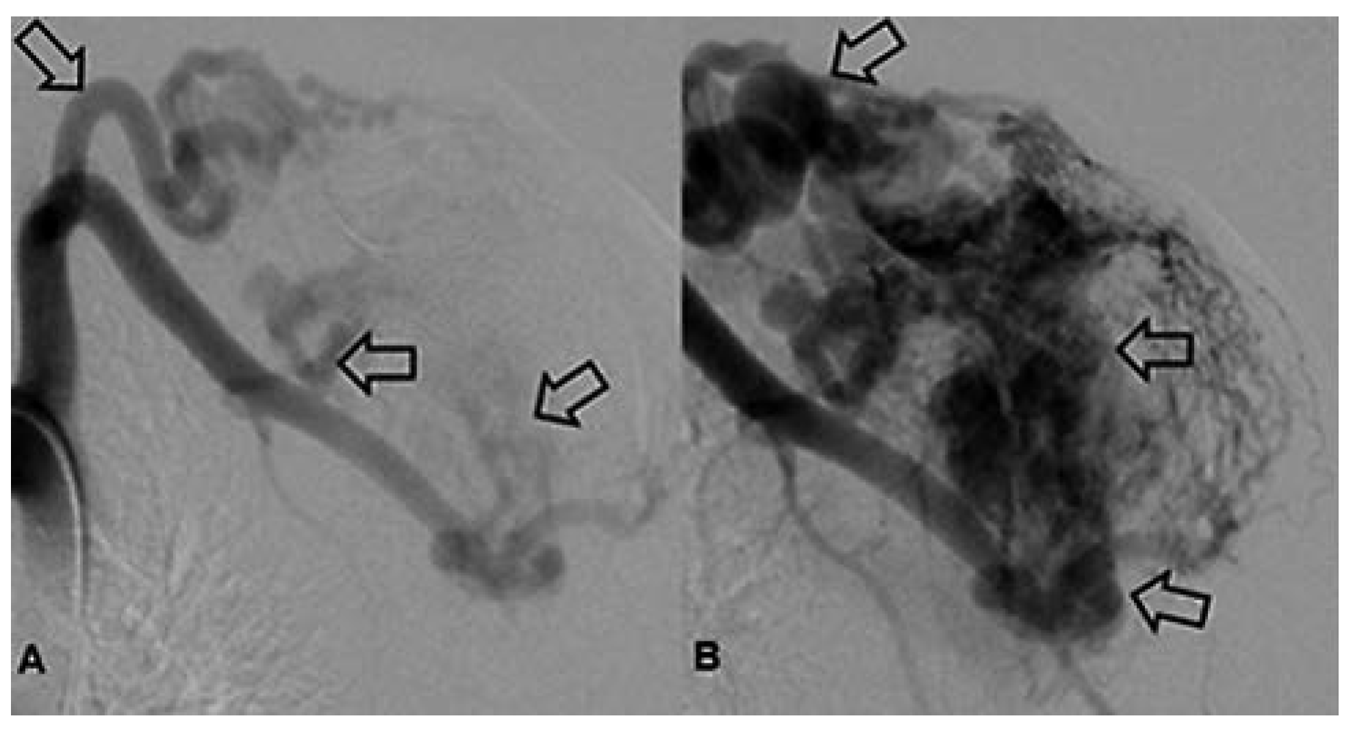 Cardiovascmed 17 00133 g012 Cardiovascmed 17 00133 g012