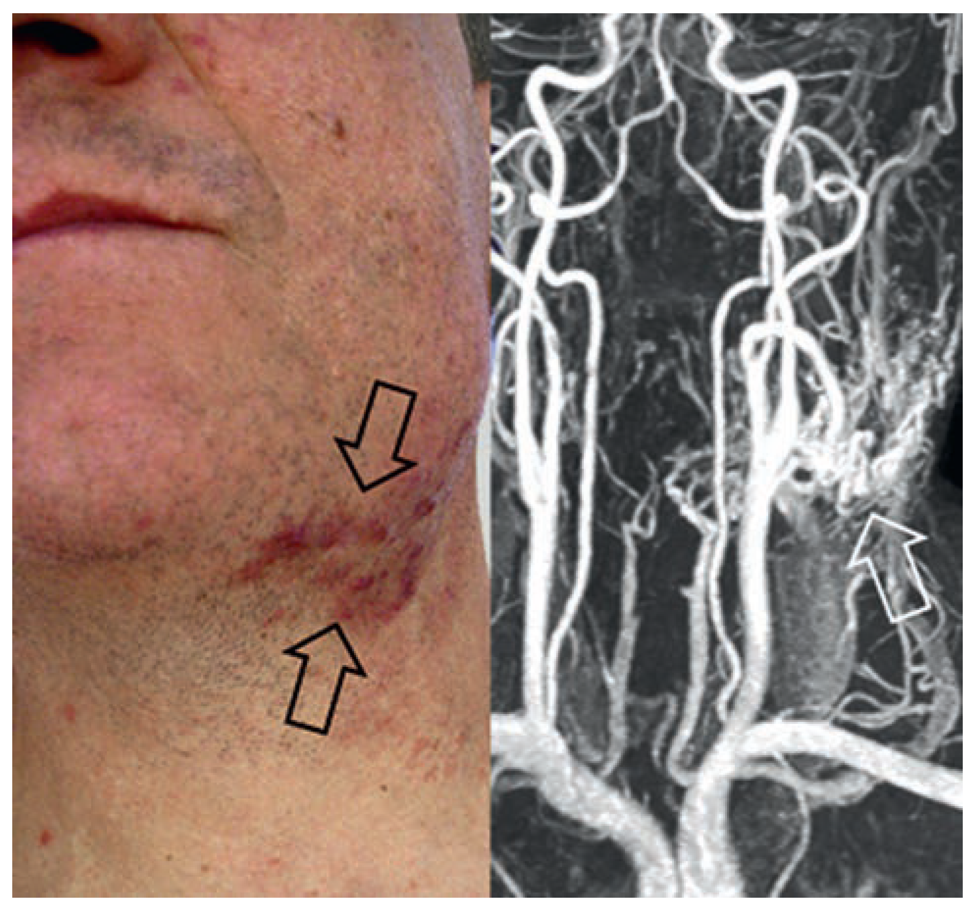 Cardiovascmed 17 00133 g013 Cardiovascmed 17 00133 g013