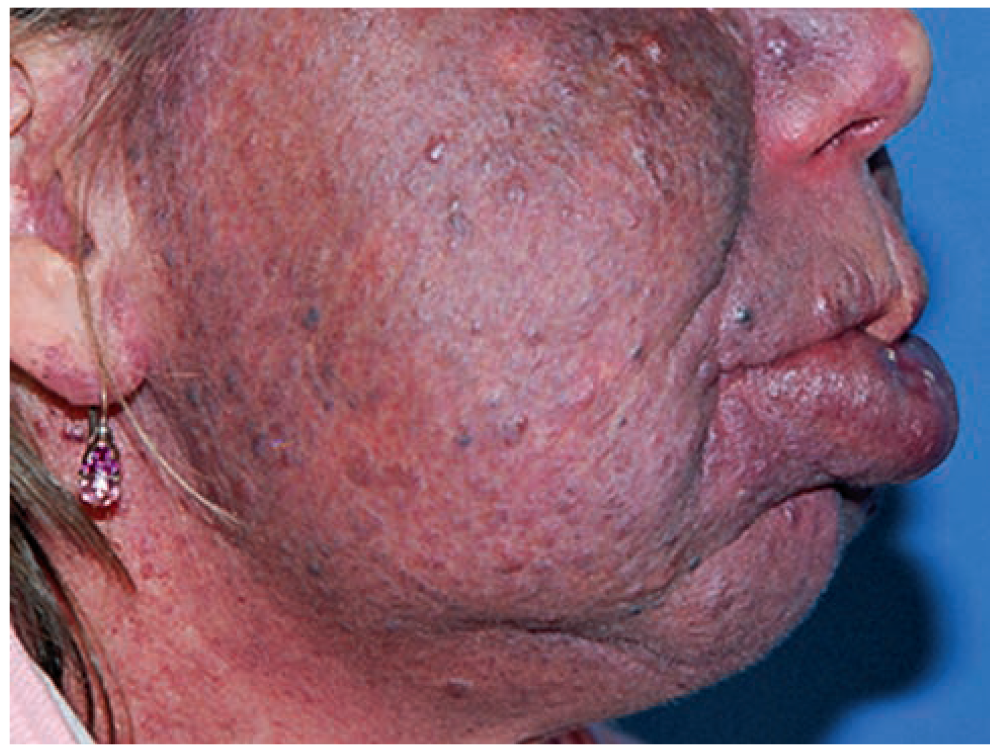 Cardiovascmed 17 00133 g016 Cardiovascmed 17 00133 g016