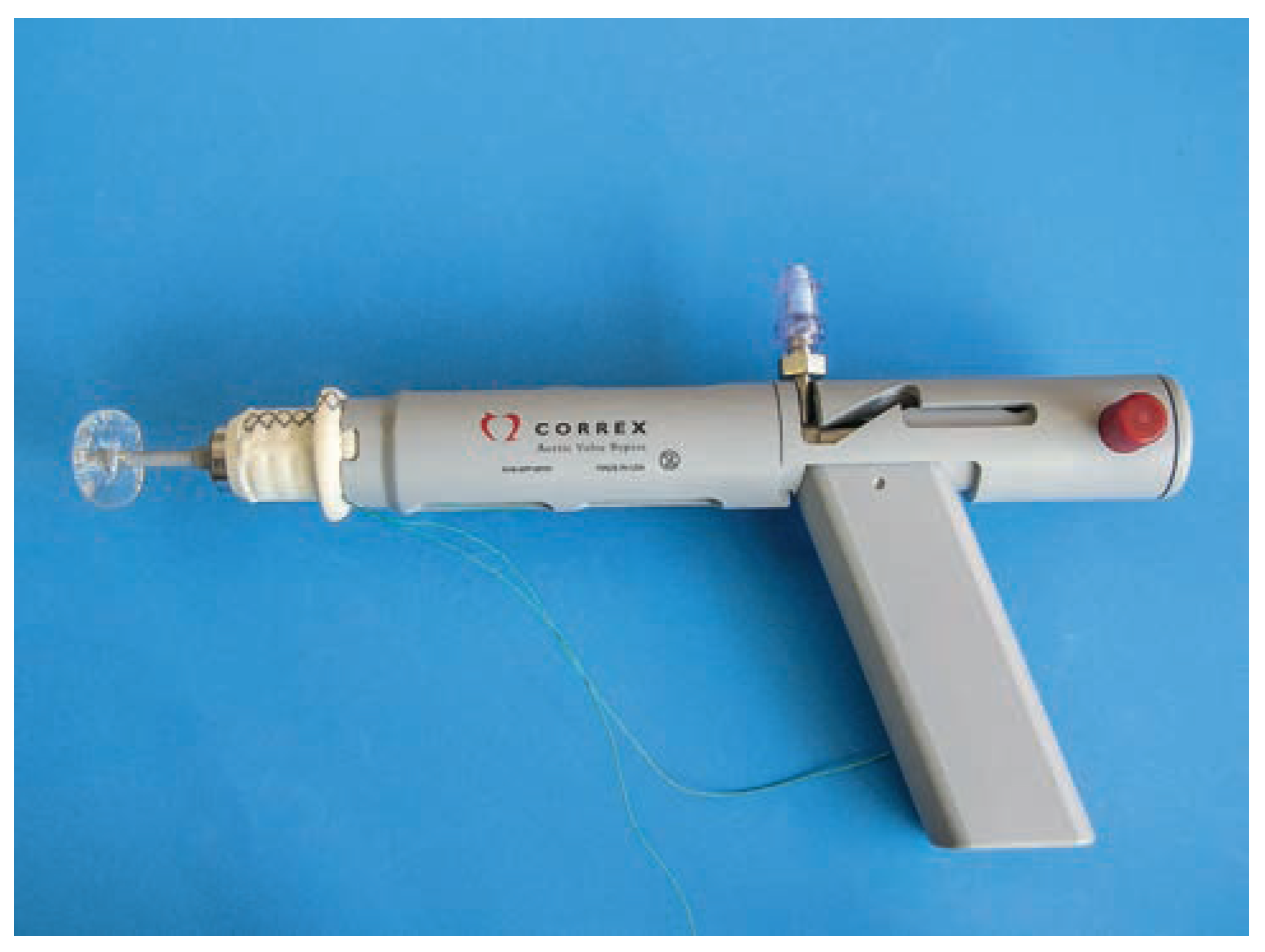 Cardiovascmed 17 00143 g002